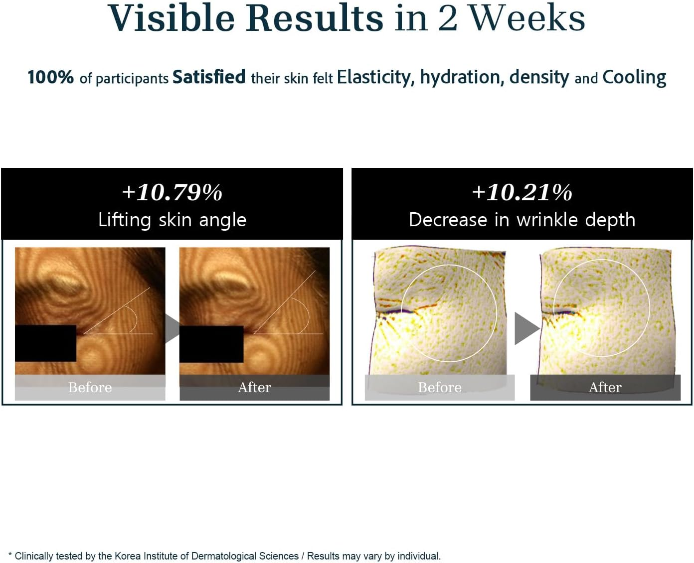 Re.Spn Peptide Firming Roller Eye Serum &ndash; for Puffy Eyes, Wrinkles & Dark Circles, Cooling Gua Sha Metal Applicator with Niacinamide, Vegan K-Beauty (0.67 Fl Oz) image number 6