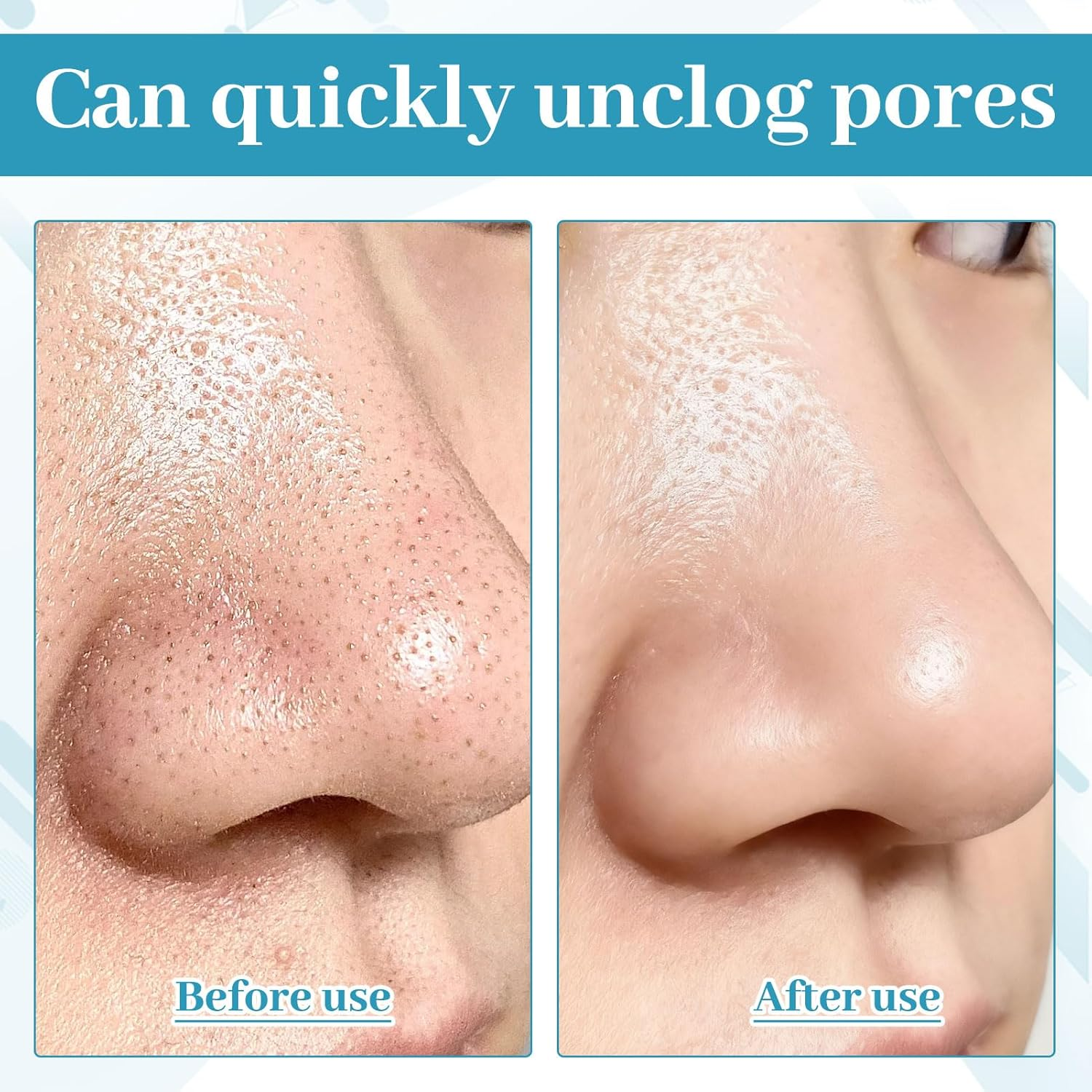 Nose Pore Strips, 50 Pcs Blackhead Strips, Nose Strips Blackhead Remover, Deep Cleansing Charcoal Black Heads Remover, Skin Care Tools with Instant Blackhead Removal, Suitable for Men and Women image number 2