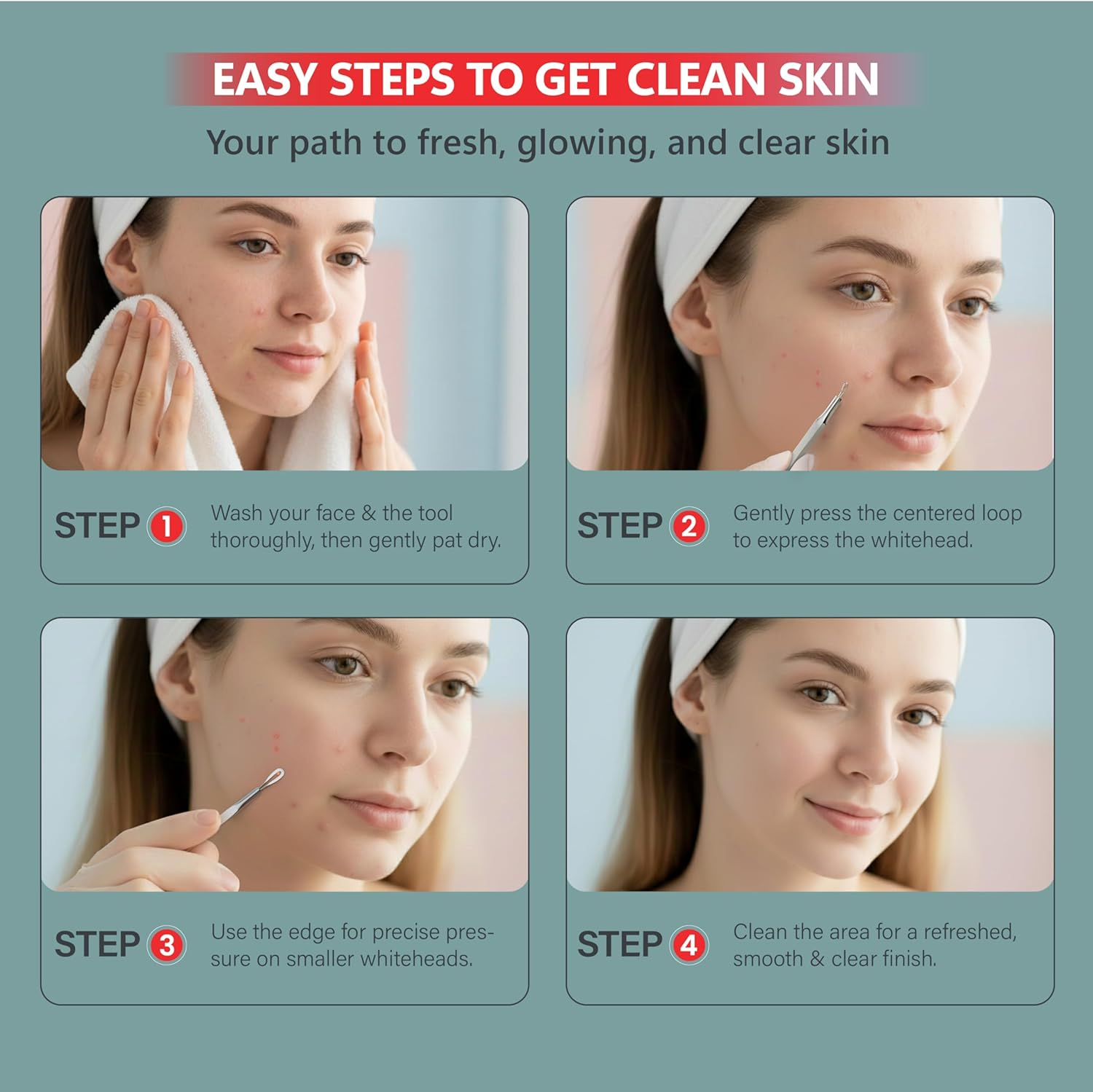 Suvorna Ador Whitehead / Acne Remover & Comedone Extractor Skinpal S25