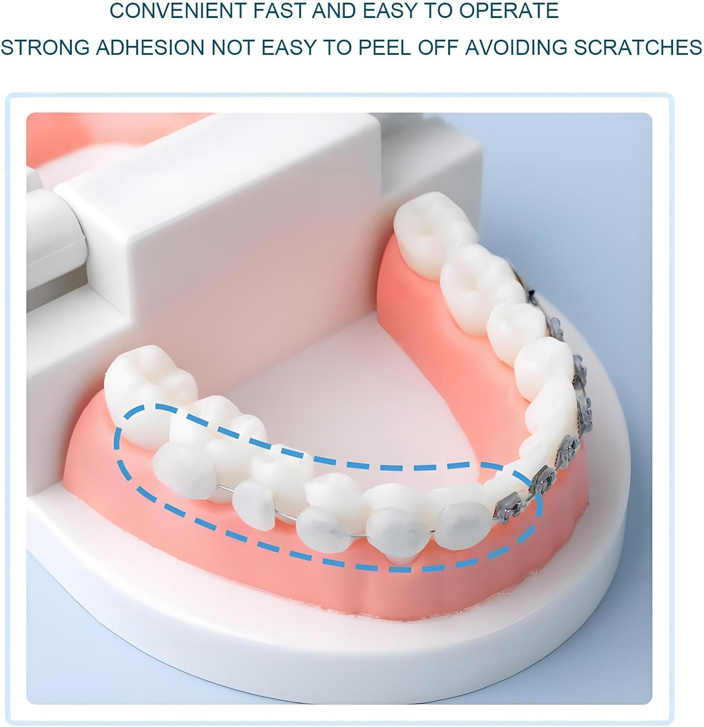 18 Pcs Braces Wax, Dental Wax, Orthodontic Cere Aligners Oral Care for Brackets, Comfort Protection for Braces Wearer, Invisible-Lingers Colorful Portable Boxes image number 6