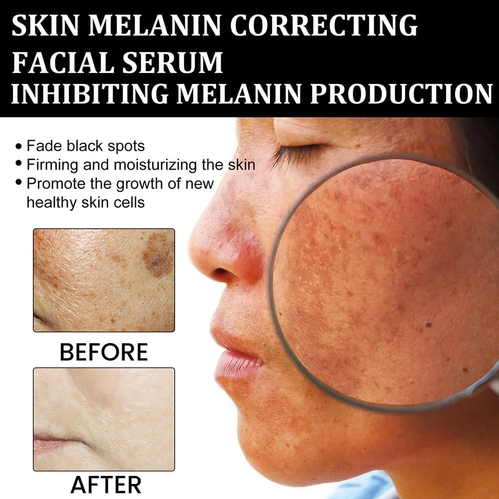 2024 Melanin Correcting Facial Serum, Dark Spot Correcting Radiance Serum,Moisturizing Repairing Serum for Glowing Skin - 3Pcs image number 4