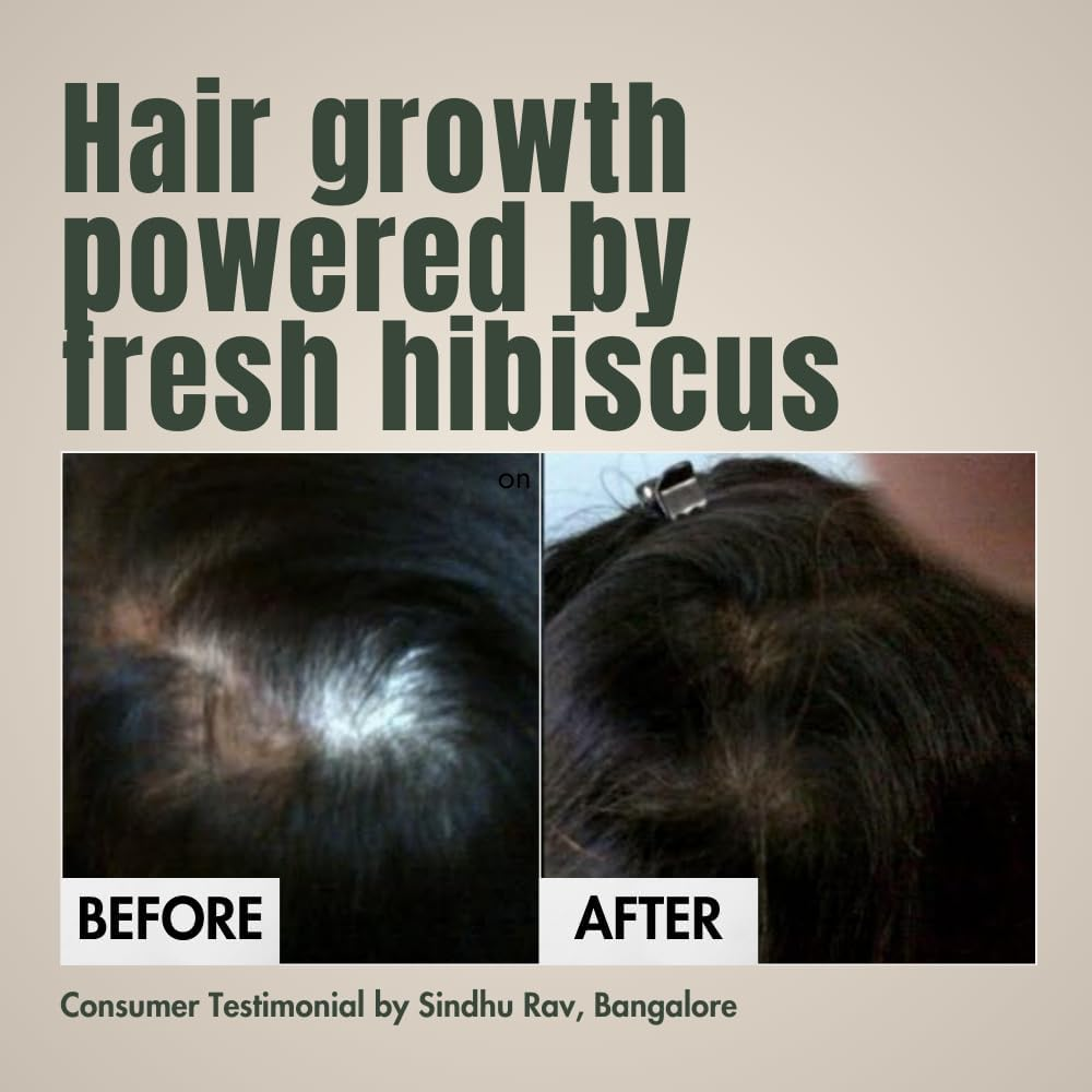 Hibiscus Monkey HM Love Scalp & Hair Oil | Non-Sticky Hair Oil | Natural Hair Oil | Anti-Frizz Hair | Promotes Hair Growth, Reduces Hairfall, Unisex | Flower and Coconut Milk Oil | image number 1