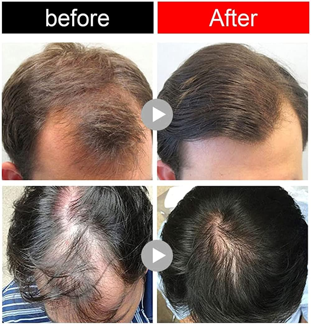 2Pcs Ginger Hair Growth Ointment,50G Natural Hair Boost Ginger Cream,Anti-Loss Dense Hair Care Serum for Thinning Hair and Hair Loss,Fast Hair Growth image number 6