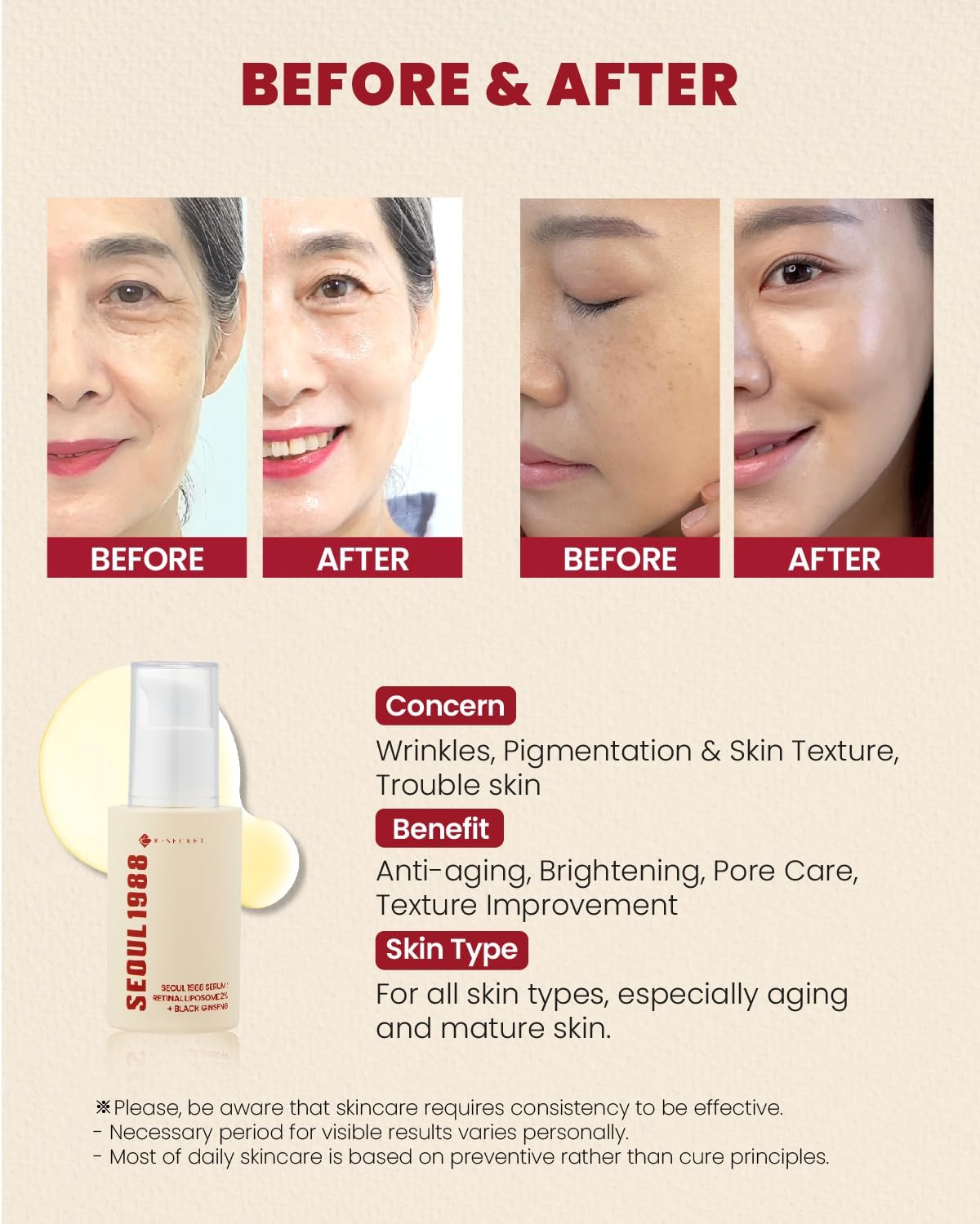 KSECRET SEOUL 1988 Serum : Retinal Liposome 2% + Black Ginseng, 30Ml/1.01Fl.Oz | 58% Black Ginseng Extract | Retinal Serum, Bakuchiol, Vitaminc&3Peptides for Wrinkle Care | Korean Skincare | Seoul1988