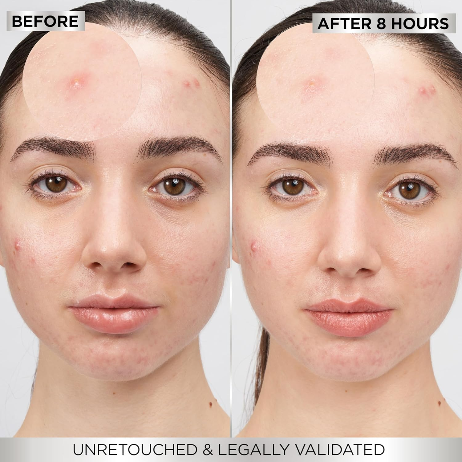 Garnier Pure Active 8Hr Pimple Patch 22Pk image number 2