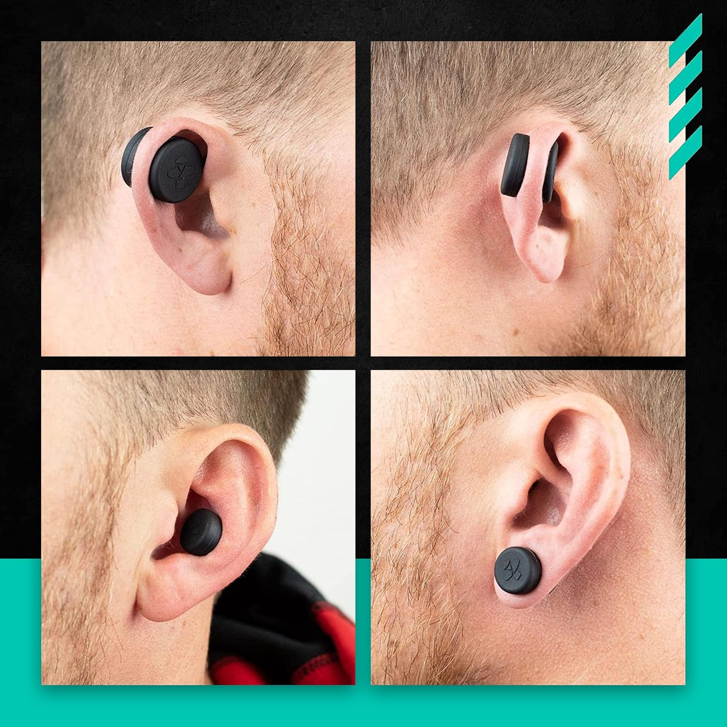 Cauliflower Ear Magnets | 8 Magnets + 8 Compression Reduction Discs Included. Cauliflower Ear Draining Kit for Treatment and Protection against Scarring image number 3