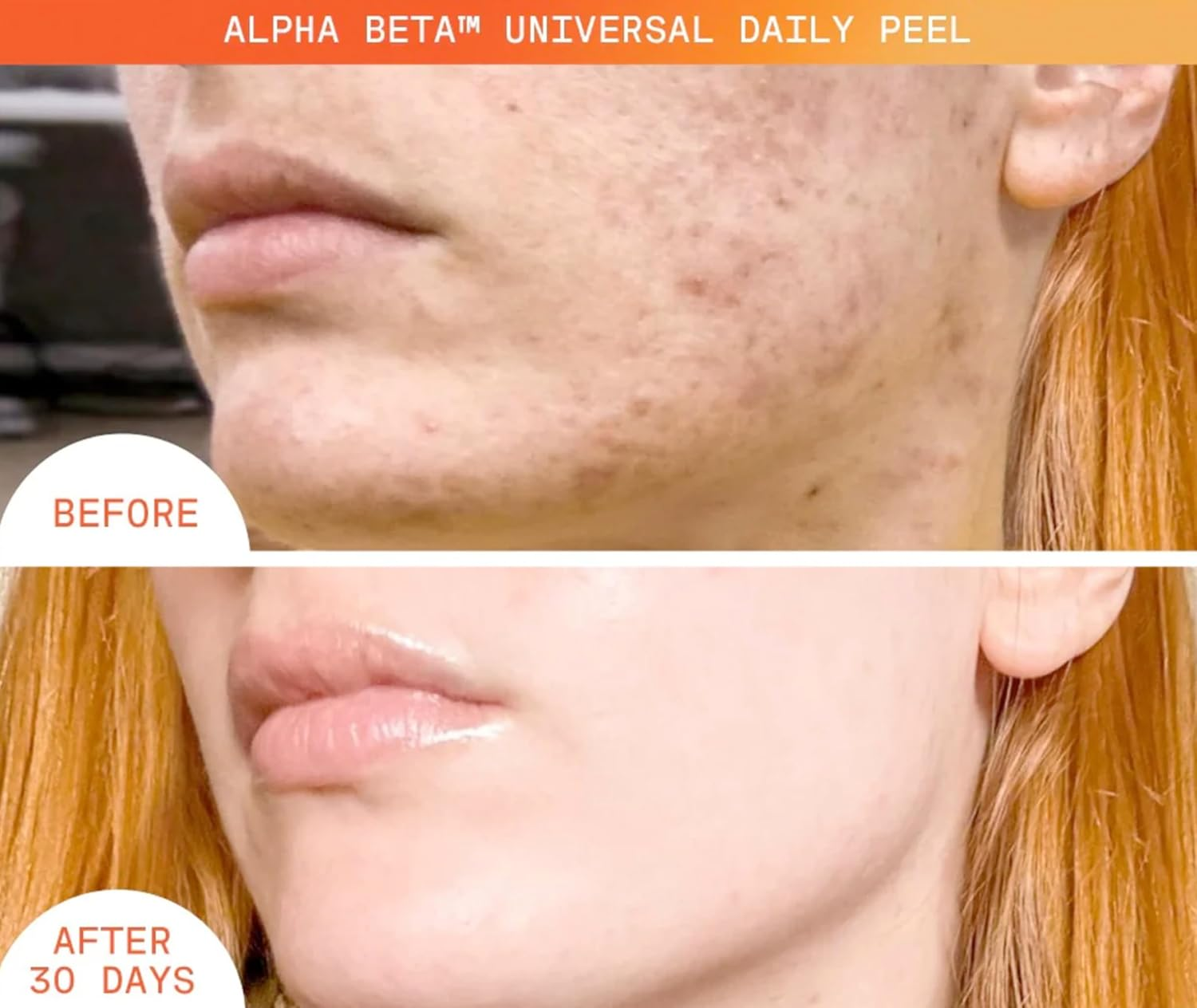 Dr Dennis Gross Alpha Beta Universal Daily Peel 5 Treatments image number 3