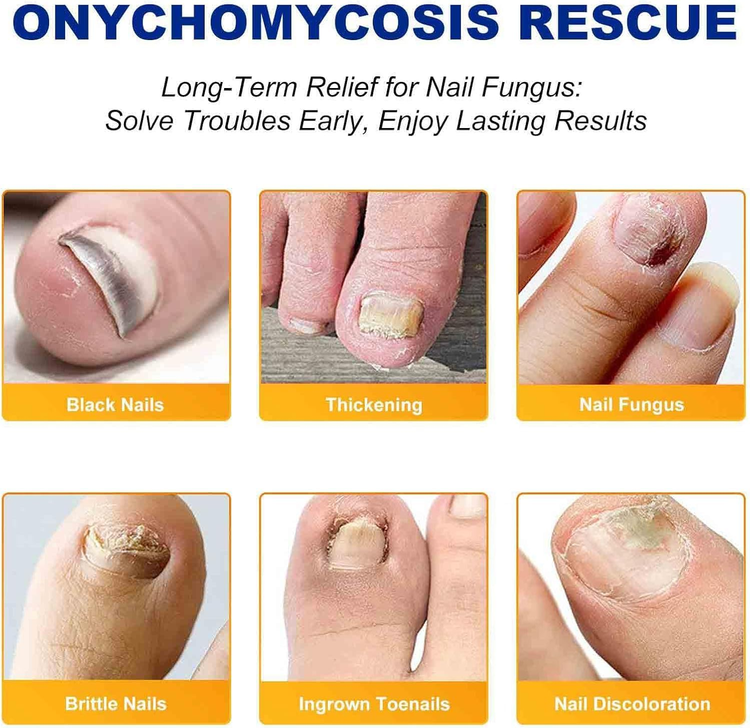 Fungal Nail Patches, Toenail Treatment Patch, Nail Repair for Damaged Nails, Improve Toenail Texture, Restore Discoloration and Thickness, Suitable for Both Men and Women image number 1