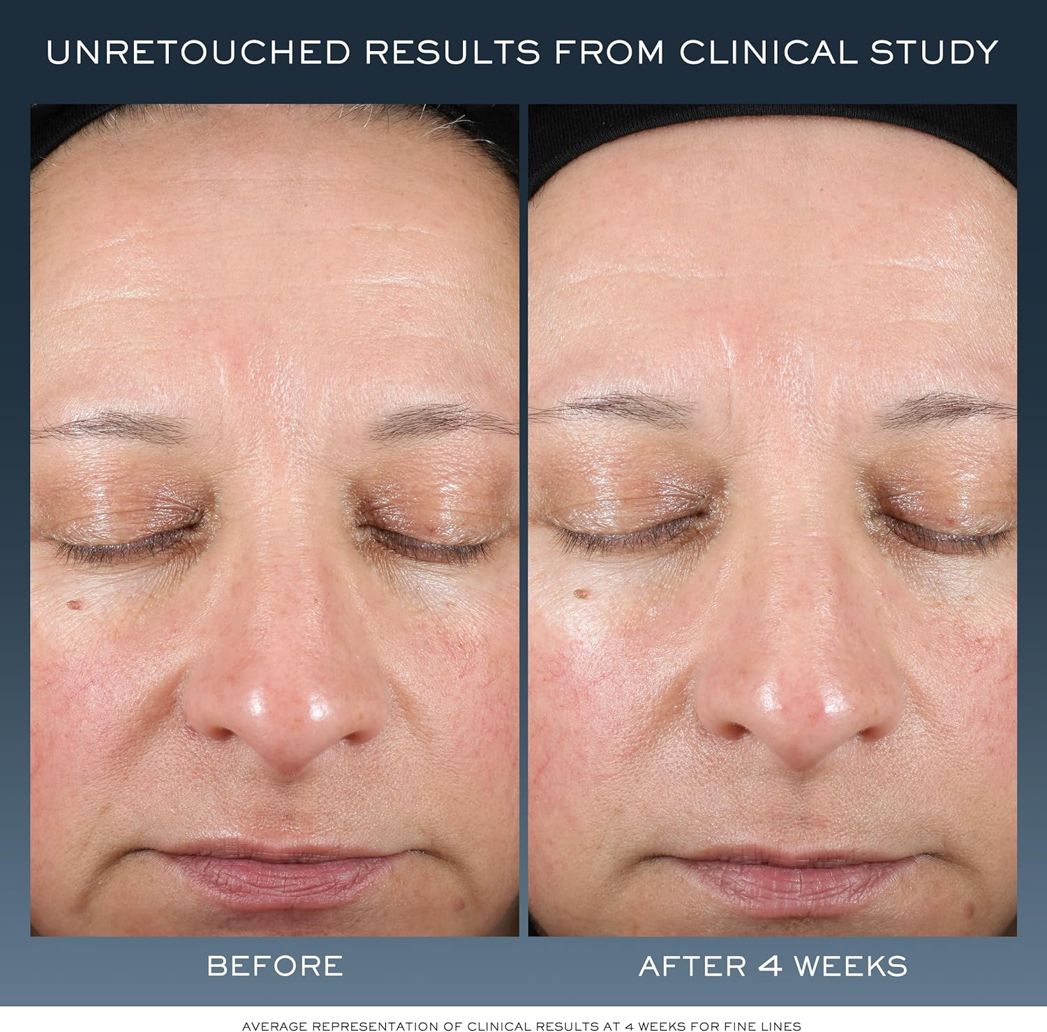 Lanc&ocirc;me GNF BARRIER NIGHT CR R22 J50ML image number 2