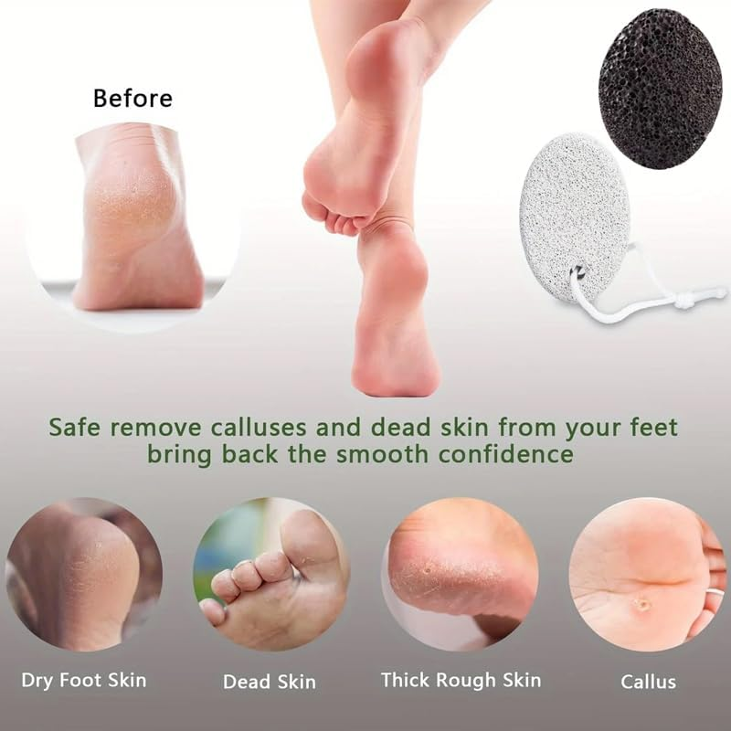 LAKYMIE Pumice Stone Foot Care Callus Remover Natural Pumice Stone for Feet and Hands Callus and Skin Hardening Removal Pack of 2