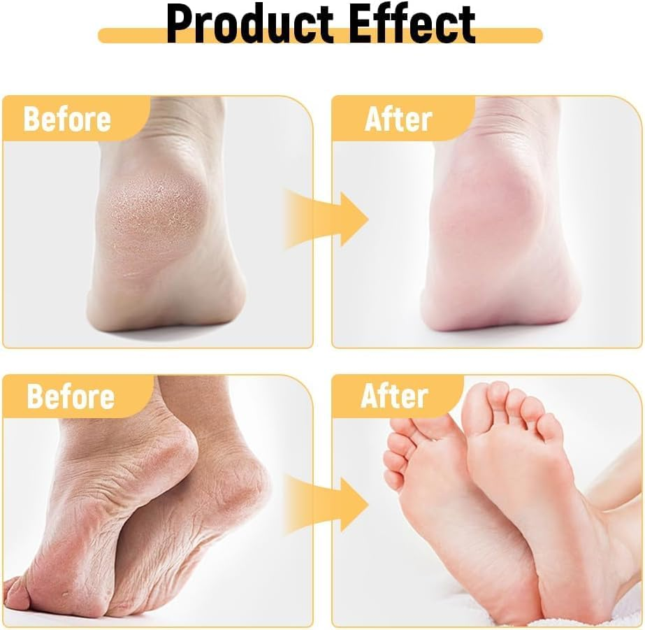 Anti-Cracking Cream, for Dry Cracked Feet and Hands, Prevent from Cracking, Make Your Feet Smooth and Soft, Deeply Moisturizing Foot Care Plant Squalane (Blue, 65G) - Blue image number 3