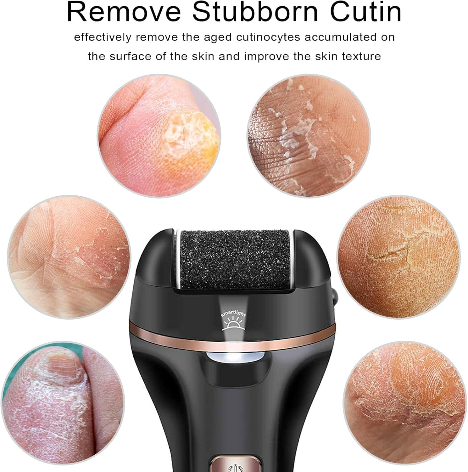 Ronluuu Electric Callus Remover for Feet, Rechargeable Portable Electronic Foot File Pedicure Kits, Professional Waterproof Pedi Feet Care Tools Wet&Dry Foot Scrubber File Perfect for Hard Cracked Dry Dead Skin (6) image number 1