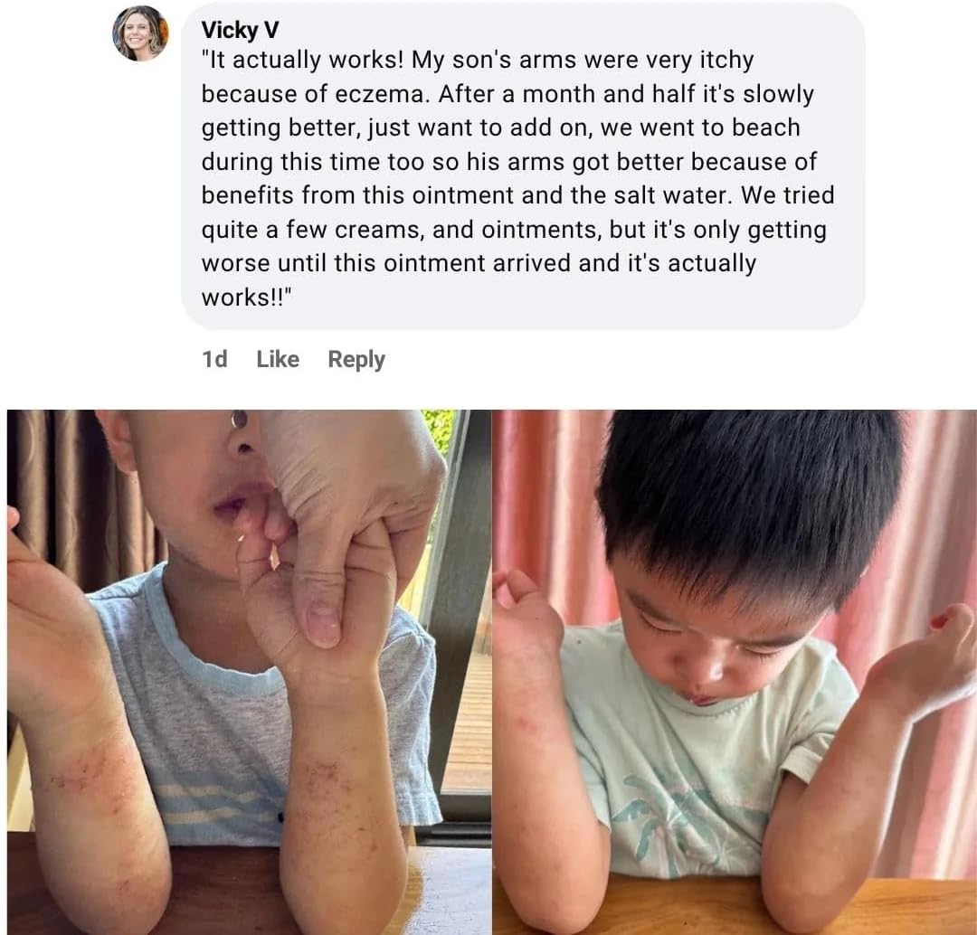 Miracle Manuka Natural Skin Balm (100G) | Botanical Blend with Manuka & Kanuka Oils | Nourishes & Soothes Dry, Sensitive Skin | Made in New Zealand image number 4