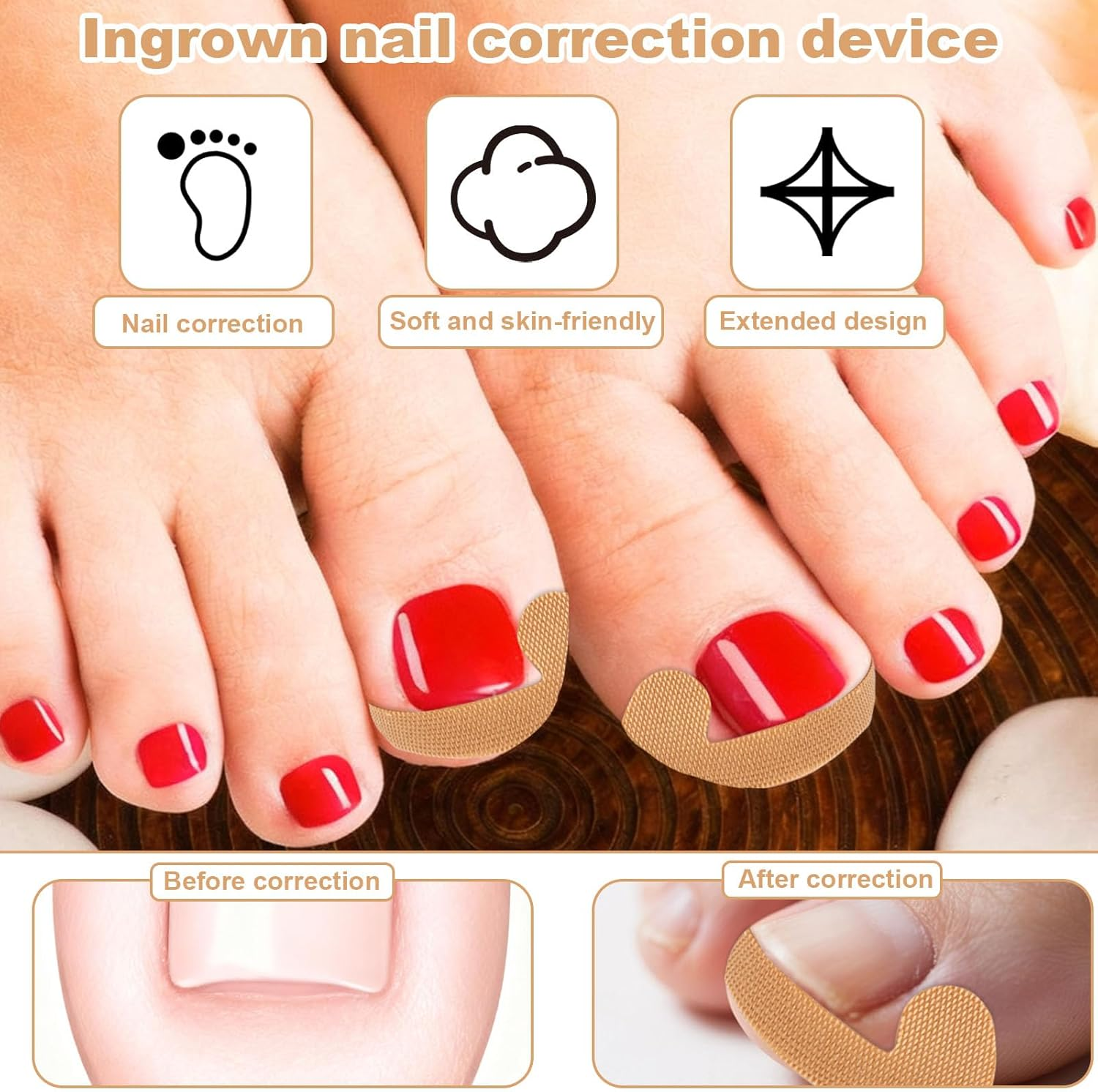 Ingrown Toenail Tool Set, Feet Pedicure Tools with Nail File & Clippers Skin Bevel Knife Toenail Groove Pick & Spoon Nail Stickers for Men Women Pedicure Tool image number 5