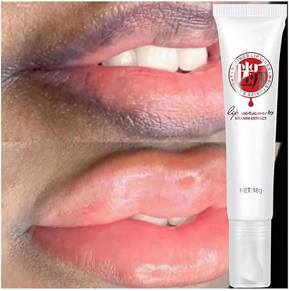 JINSHANE Lip Serum, Jinshane Lip, Jinshane Lip Brightening, Jinshane Dark Lip Treatment, Lip Fresh Treatment Remove Dark Lip, Lip Balms Moisturizer Nourishing Essence (6Pcs) - 1Pcs image number 2