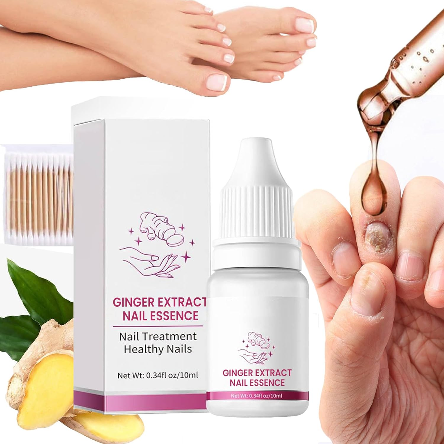 Fungigone Nail Treatment, Fungigone Nail Fungus Removal, 7 Days Nail Fungus Treatment for Toenail, Foot F-Ungus Treatments Nails Care Solution for Toenails & Fingernails (3 PC)