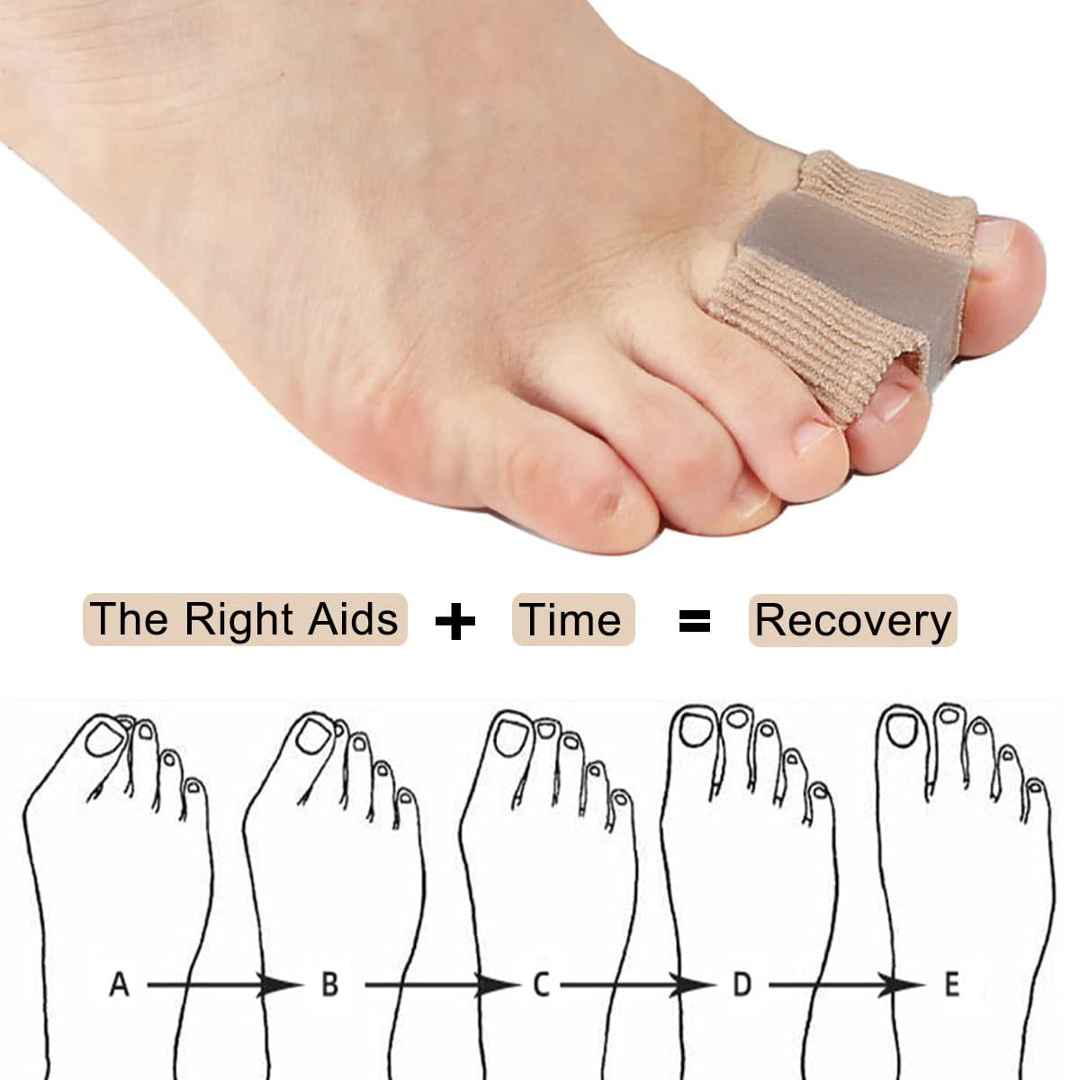 IKEEPVOX Gel Bunion Toe Separators &ndash; Overlapping Toe Corrector with 2 Loops for Hammer Toe & Hallux Valgus Relief, Flexible Toe Spacers for Women & Men (2-Pack) image number 5