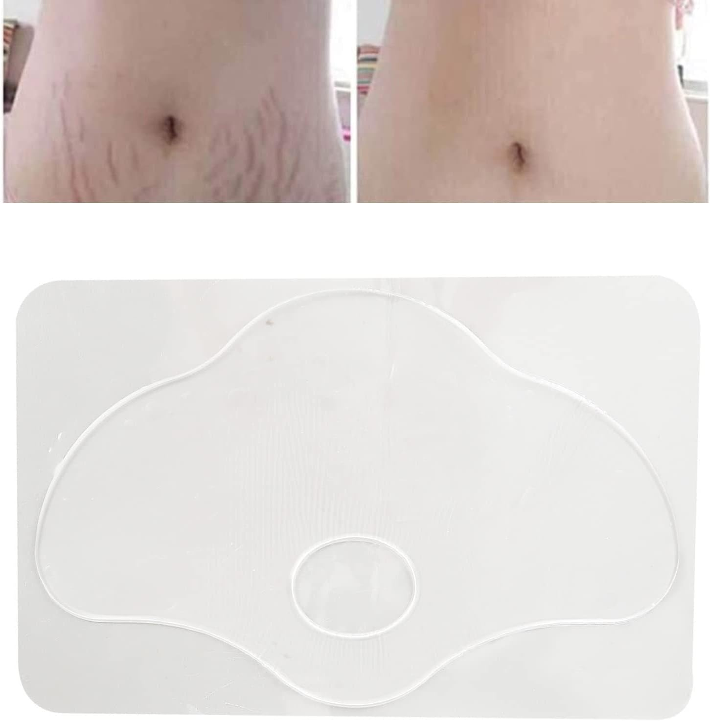 Stretch Mark Patch, Reusable Silicone Scar Removal Sheets, Silicone Anti-Aging Patches for Scar Stretch Marks and Belly Button Scar Removal Patches and Stretch Mark Removal Pads Qarido image number 6