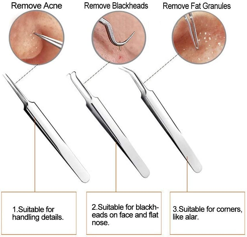 Blackhead Remover Kit - FEITA Blackhead Tweezers Removal Tool Kit Set - Acne Tweezers Pimple Comedone Extractor with Travel Case (5 Pcs) image number 1