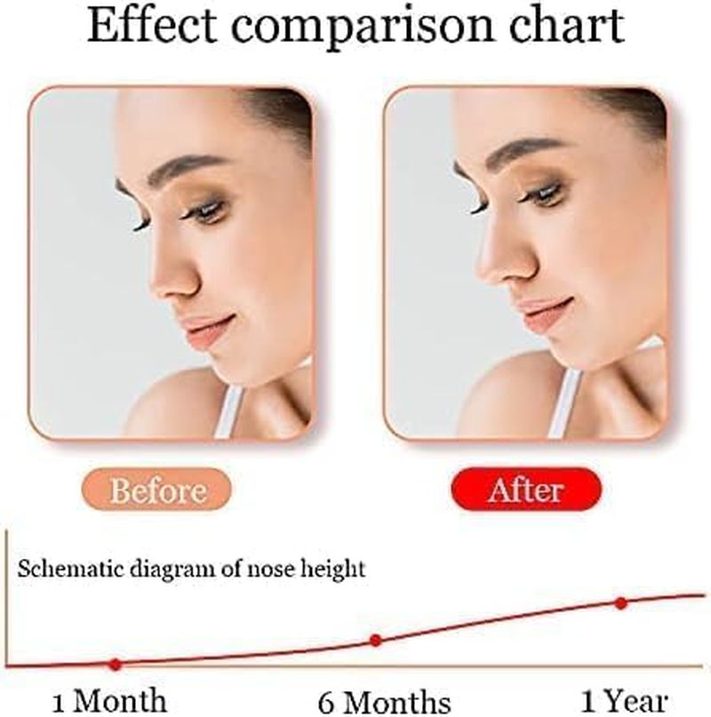 Nose Shaper Lifter Clip, Silicone Beauty up Lifting Soft Safety Pain-Free Silicone Nose Corrector, Bridge Straightener Shrinker for Wide Noses (Blue, One Size)