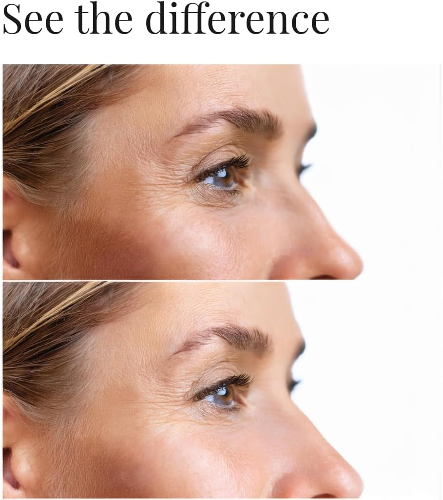 Rejuvenating Anti-Aging Eye Cream | Reduces Wrinkles, Dark Circles, and Under-Eye Bags image number 4