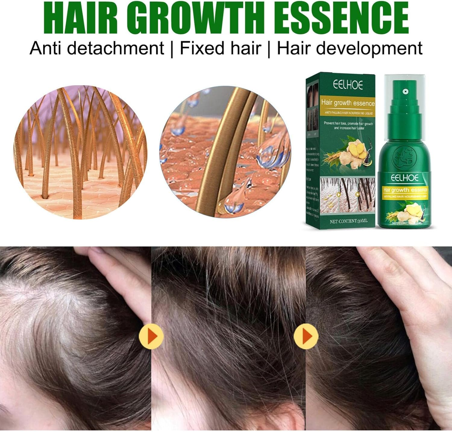 5 Pcs Organic Growth Ginger Spray | Hair Regrowth Spray for Hair Rapid Growth | Safe and Healthy Organic Growth Hair Care Nutrition Spray Dobooo image number 3