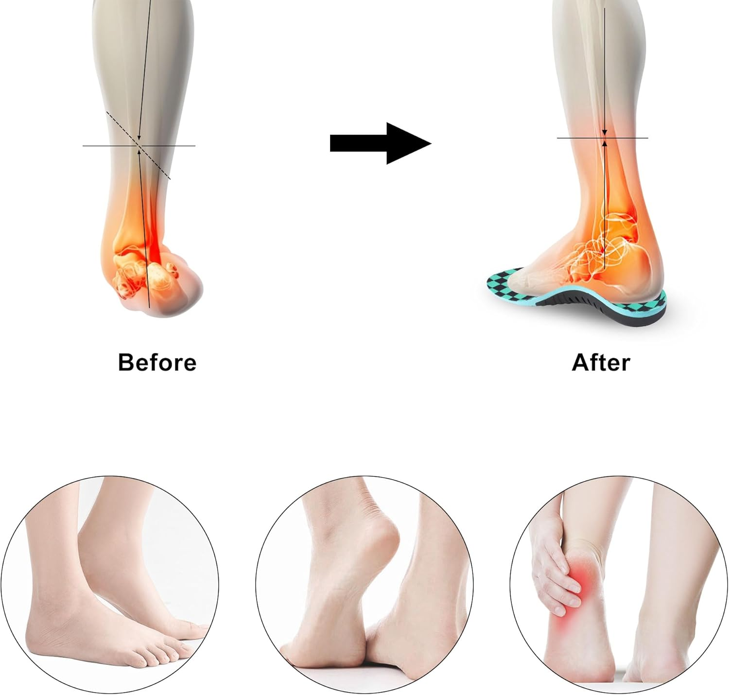 Arch Support Insoles Plantar Fasciitis Insoles, Orthotic Insoles with Strong Arch Support to Soothe Heel Pain and Heel Spurs (Green, S(EU 40-42)) image number 3