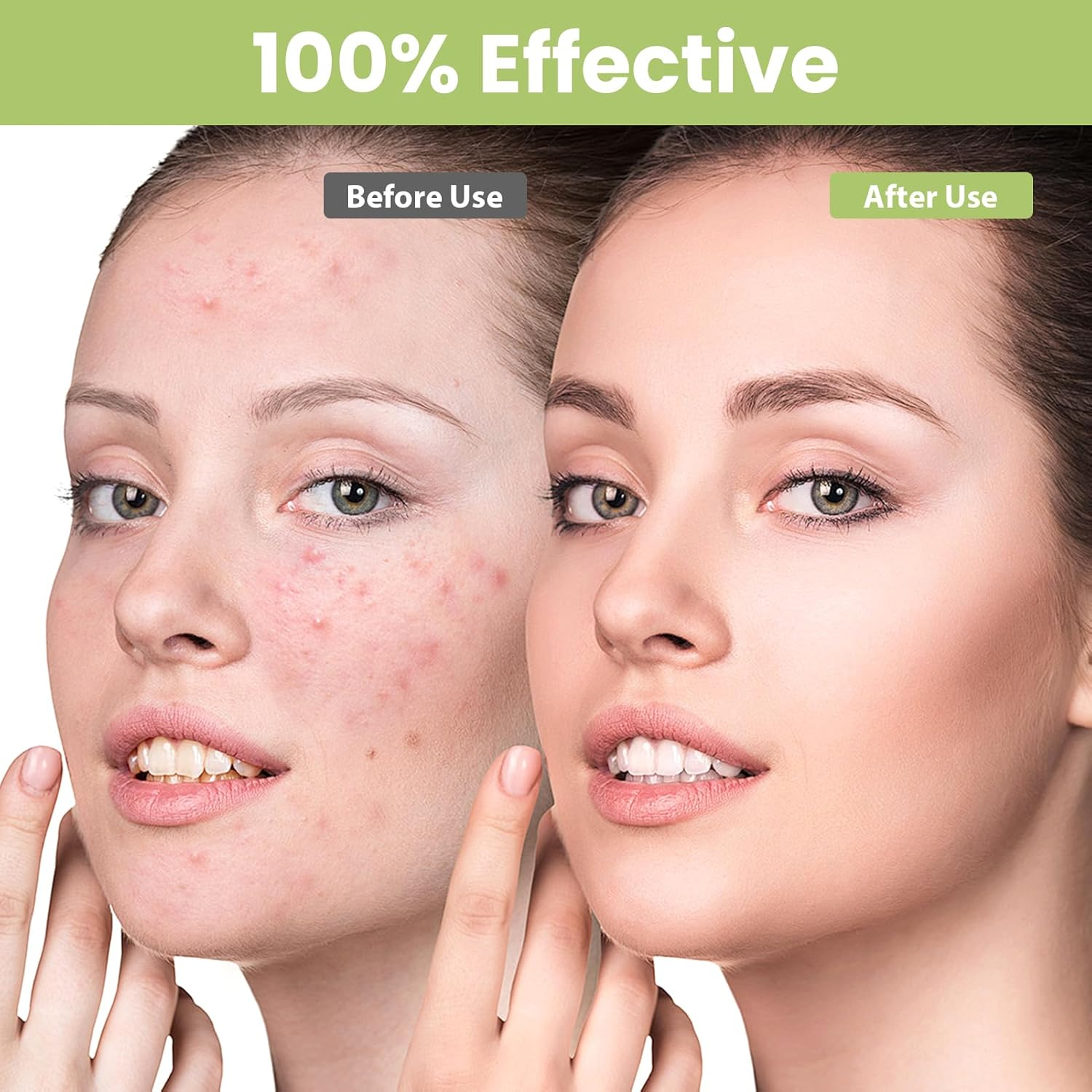 9 Pcs Blackhead Remover Kit - Acne Removal Popper Tool Sets for Blackheads, Whiteheads, Zits & Blemishes, Premium Stainless Steel Comedone Extractor with Portable Leather Case for Skin Care image number 2