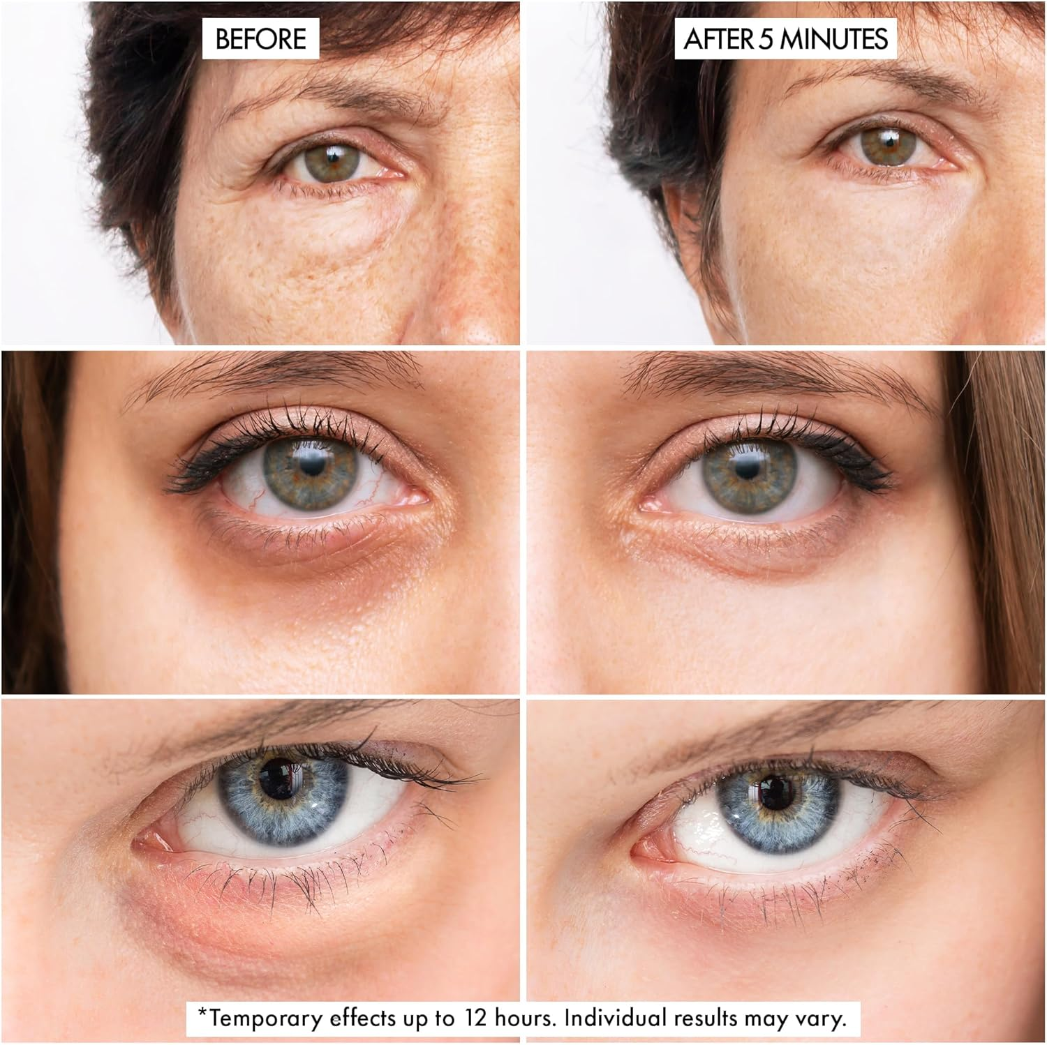 Bag Buster Instant Eye Bag Remover &ndash; Rapid Reduction Serum with Silicate & Peptide Complex &ndash; Visibly Smooths Under‑Eye Bags, Puffiness & Fine Lines in 3 Minutes (10 Ml) image number 2