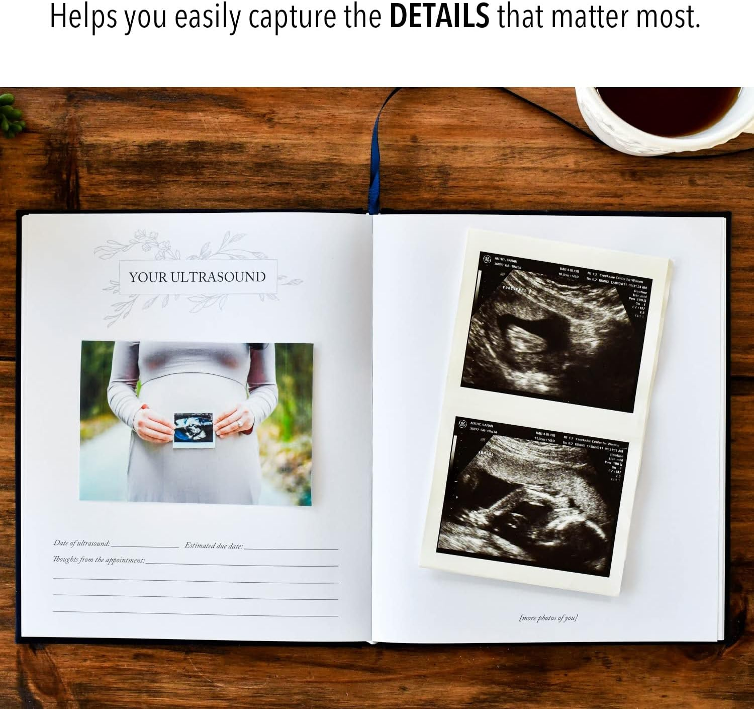 Dear Baby: a Pregnancy Prayer Journal and Memory Book for Expecting Moms image number 4