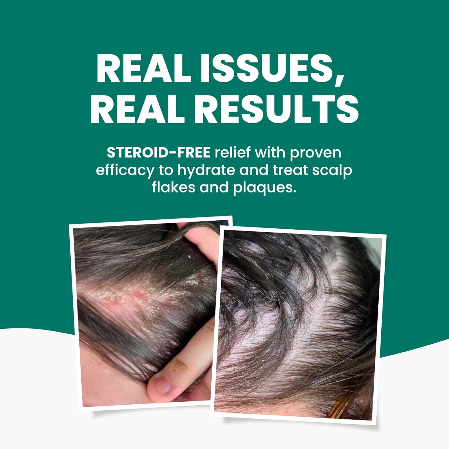 Grahams Natural Scalp Relief Cream - Seborrheic Dermatitis, Dandruff Scalp Treatment - Moisturises Dry, Itchy & Flaky Scalps - Manuka Honey, Calendula, Jojoba Seed Oil (1 X 60G) image number 6