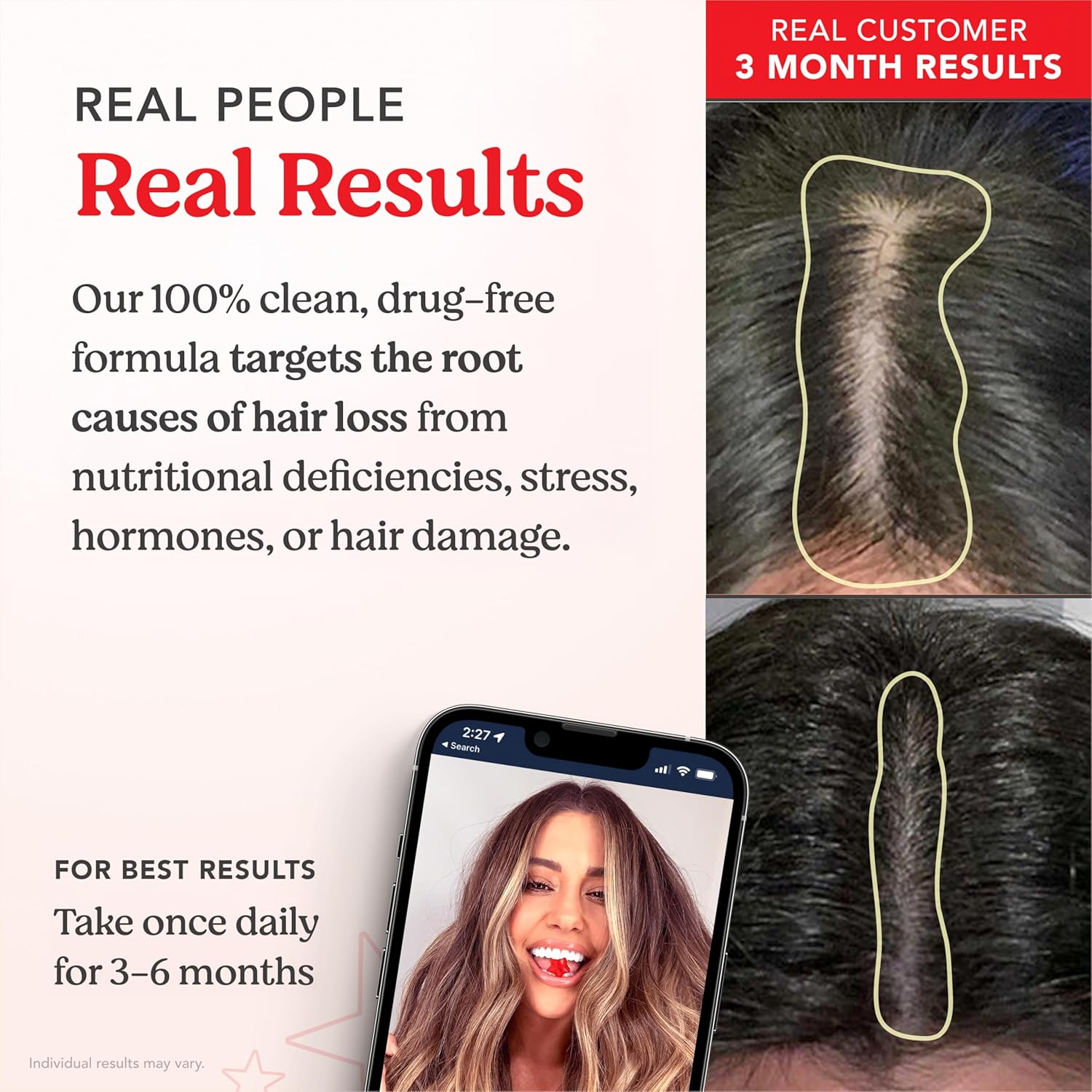 Hairtamin Star Gummy Hair Vitamins - Made in USA - Biotin Gummies Hair Vitamins for Faster Hair Growth for Women & Men - Gluten-Free, Low Carb, Vegan Hair Supplement Multivitamin for Hair Skin Nails