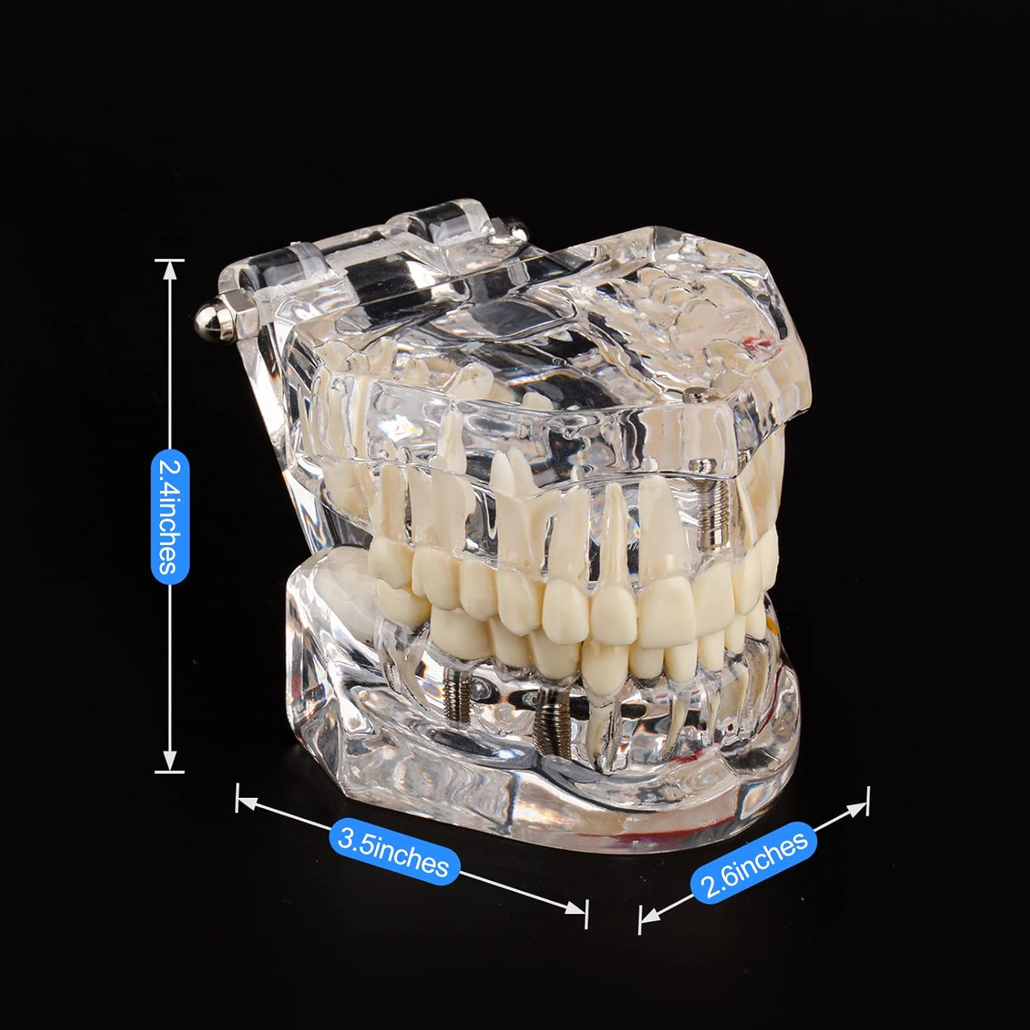 Ultrassist Transparent Disease Teeth Model image number 4