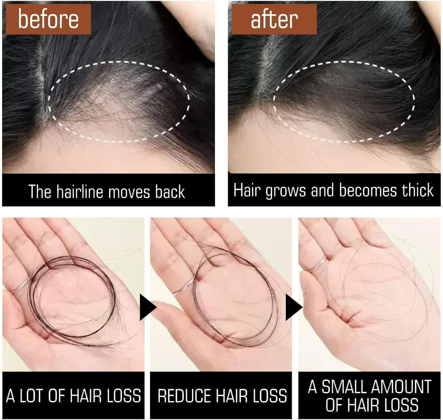 LYSYYAZ Deoxyribose Gel Hair Growth Serum, 60Ml, Unisex-Adults, Clear, Gel Form, for Hair Loss & Thinning, 1 Pcs image number 2