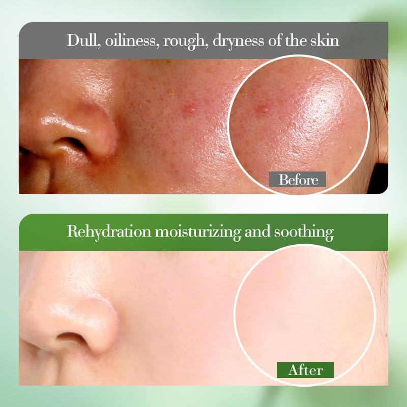 Aloe Vera Moisturizing & Soothing Serum, 40Ml, Improves the Appearance of Rough, Dehydrated Skin, Moisturizes and Nourishes the Skin for a Long Time, Soothes and Rejuvenates the Skin. image number 2