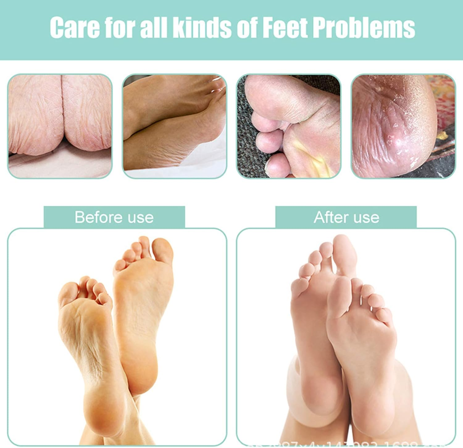 Electric Foot Grinder Callus Remover USB Rechargeable Foot Care Tool with 3 Roller Heads image number 5