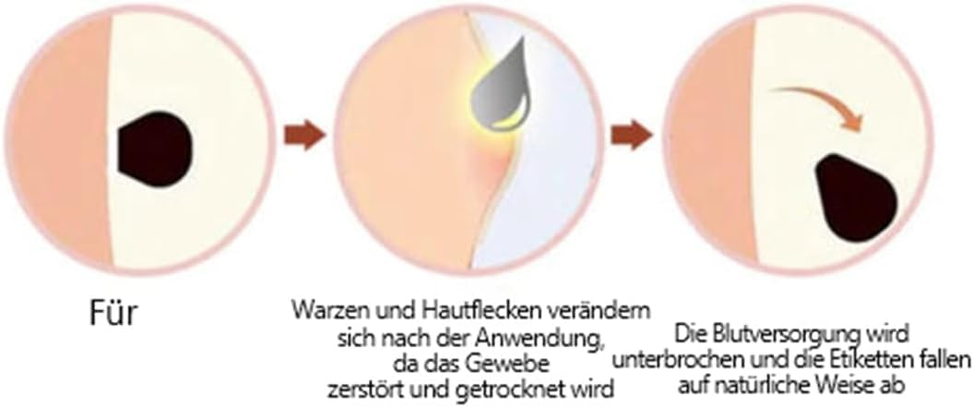 Zmbdz Lenaro Bee Venom Repair Cream Hydrating Moisturizing Cream Remove Spots for Women All Skin 2Pcs