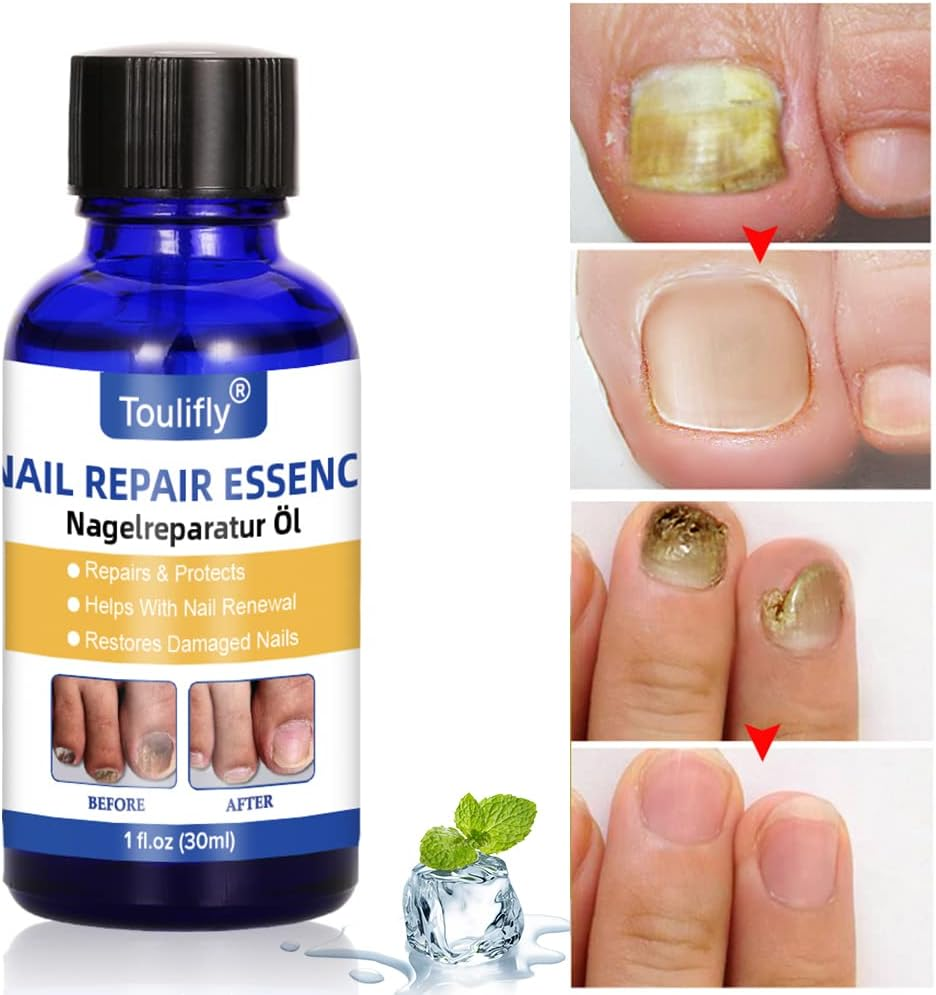 Nail Care and Treatment, Nail Care for Healthy Foot and Hand, Nail Care Oil, Nail Care image number 4