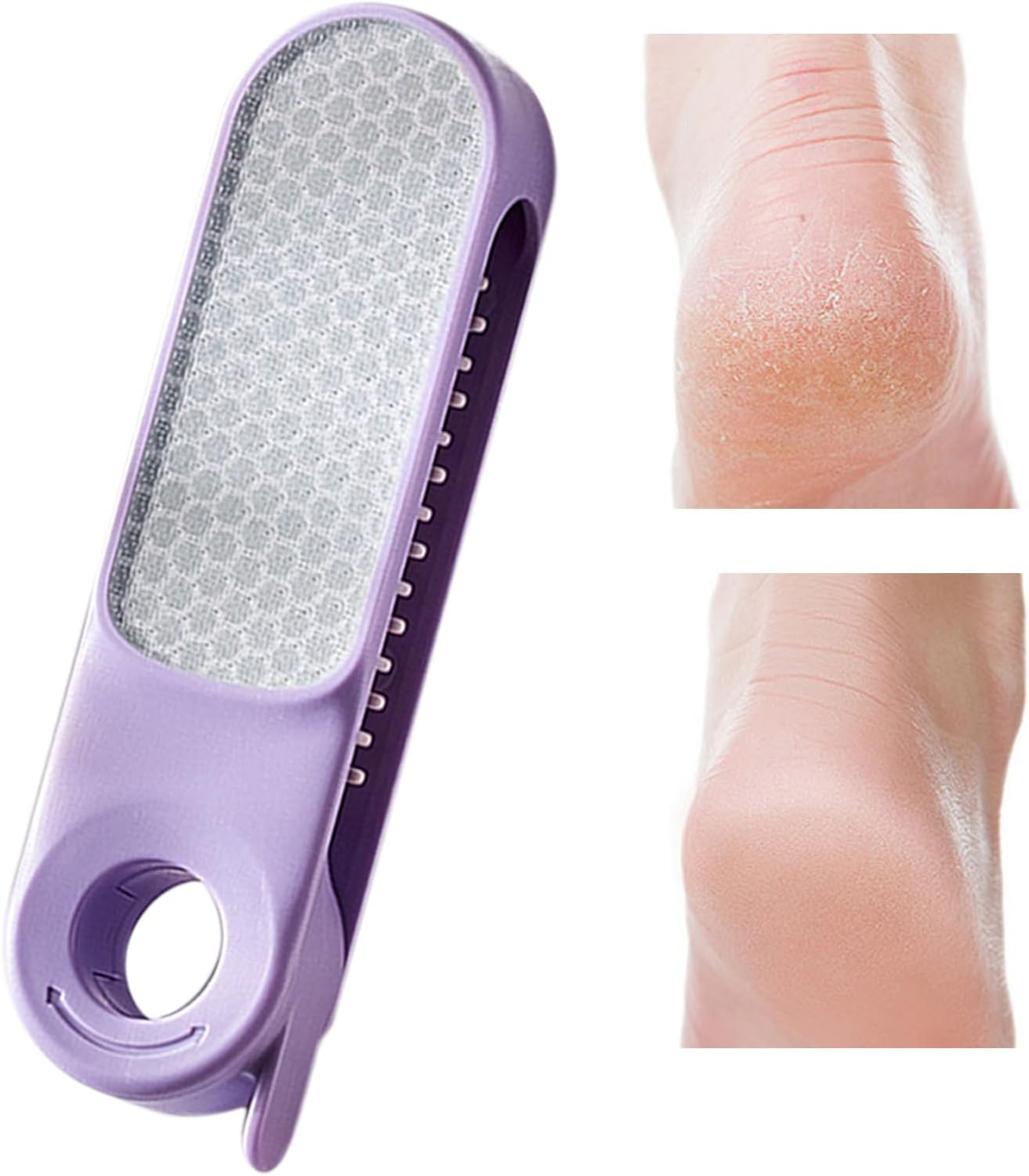 Zasdvn Callus Remover - Dead Skin Pedicure Tools,Gentle Hard Skin Removal File for Adults Seniors Daily Maintenance Post-Shower Home Spa Travel