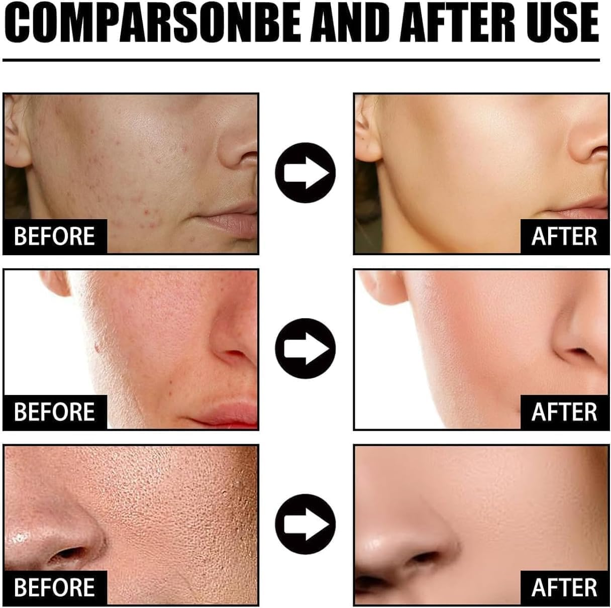 2Pcs Nicotinamide Serum for Blemishes,Niacinamide Freckles Removal Serum,Niacinamide Spots Removal Serum,Niacinamide Serum for All Type Skin image number 6