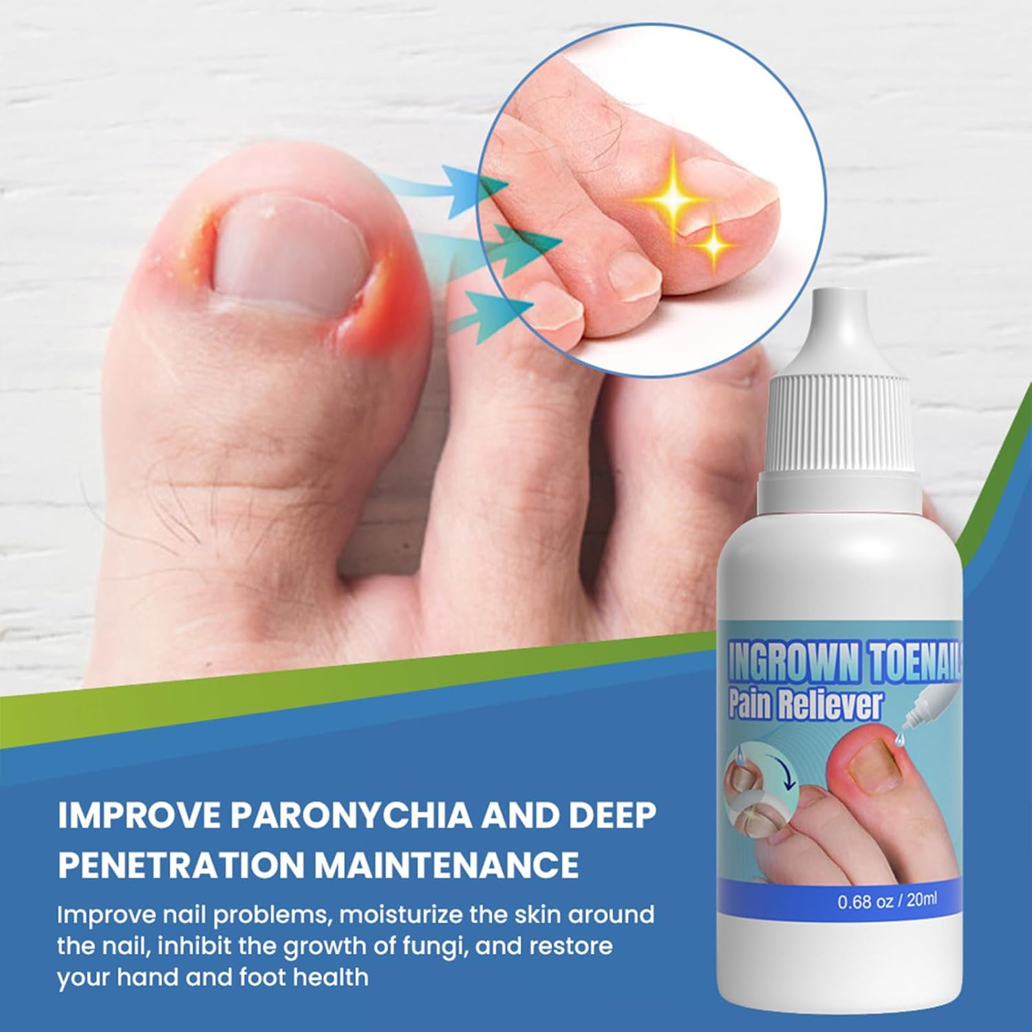 Ingrown Toenail Treatment - Ingrowing Toenail Treatments - Ingrown Nail Treatment for Toenails Extra-Strong image number 6