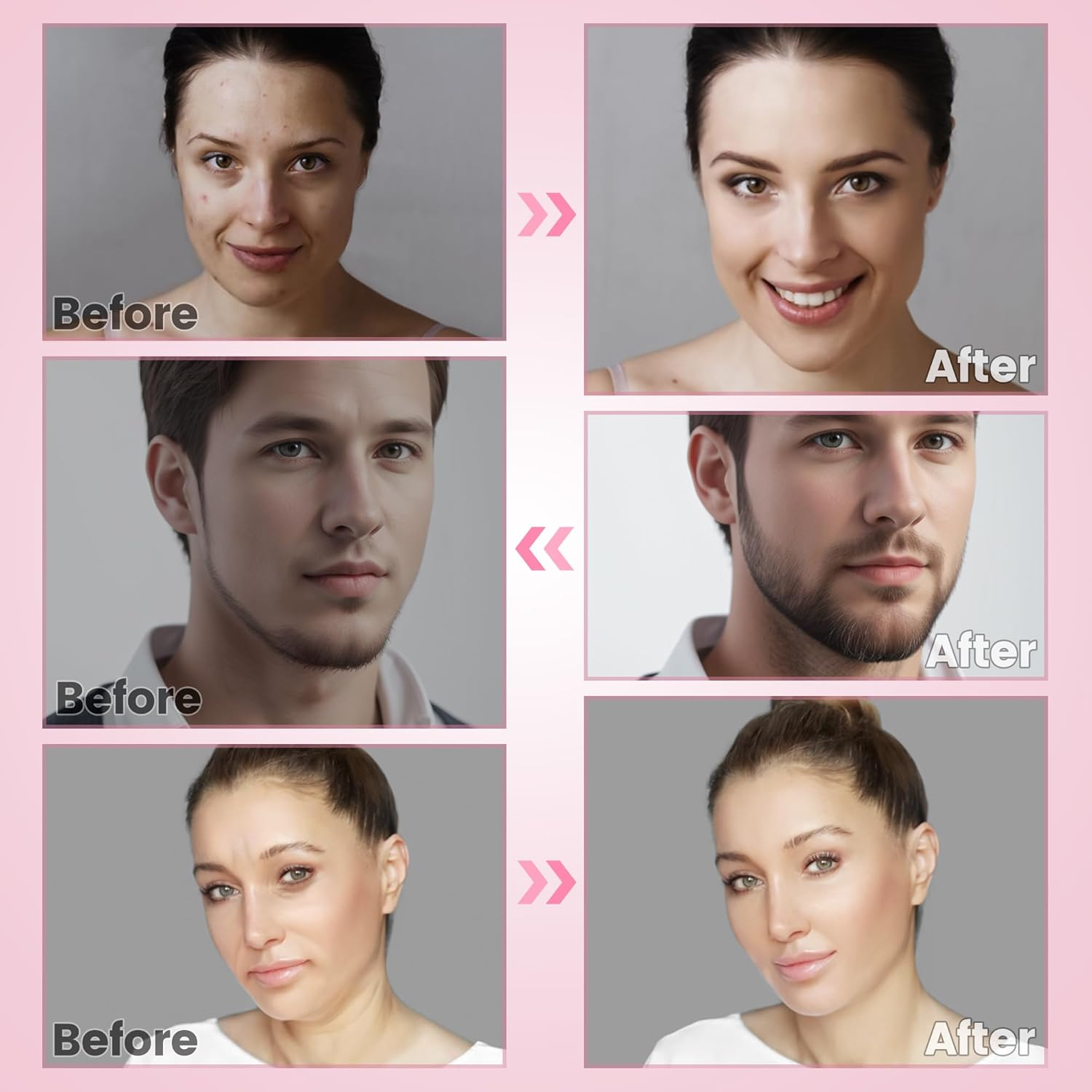 Less than 0.2Mm Derma Roller Pen image number 1