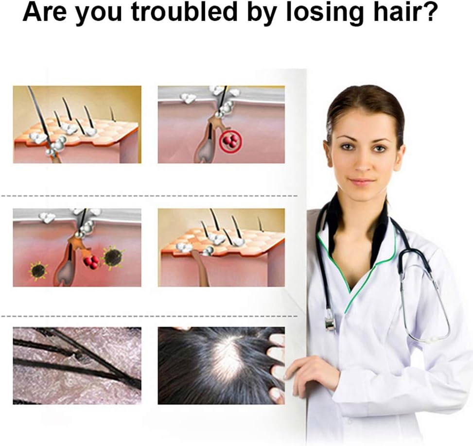 Chusui Hair Growth Essence 30Ml Effective Scalp Nutritious Repair Hair Growth Enhance Tool Hair Care Healthy Hair Growth Essence Oil image number 2