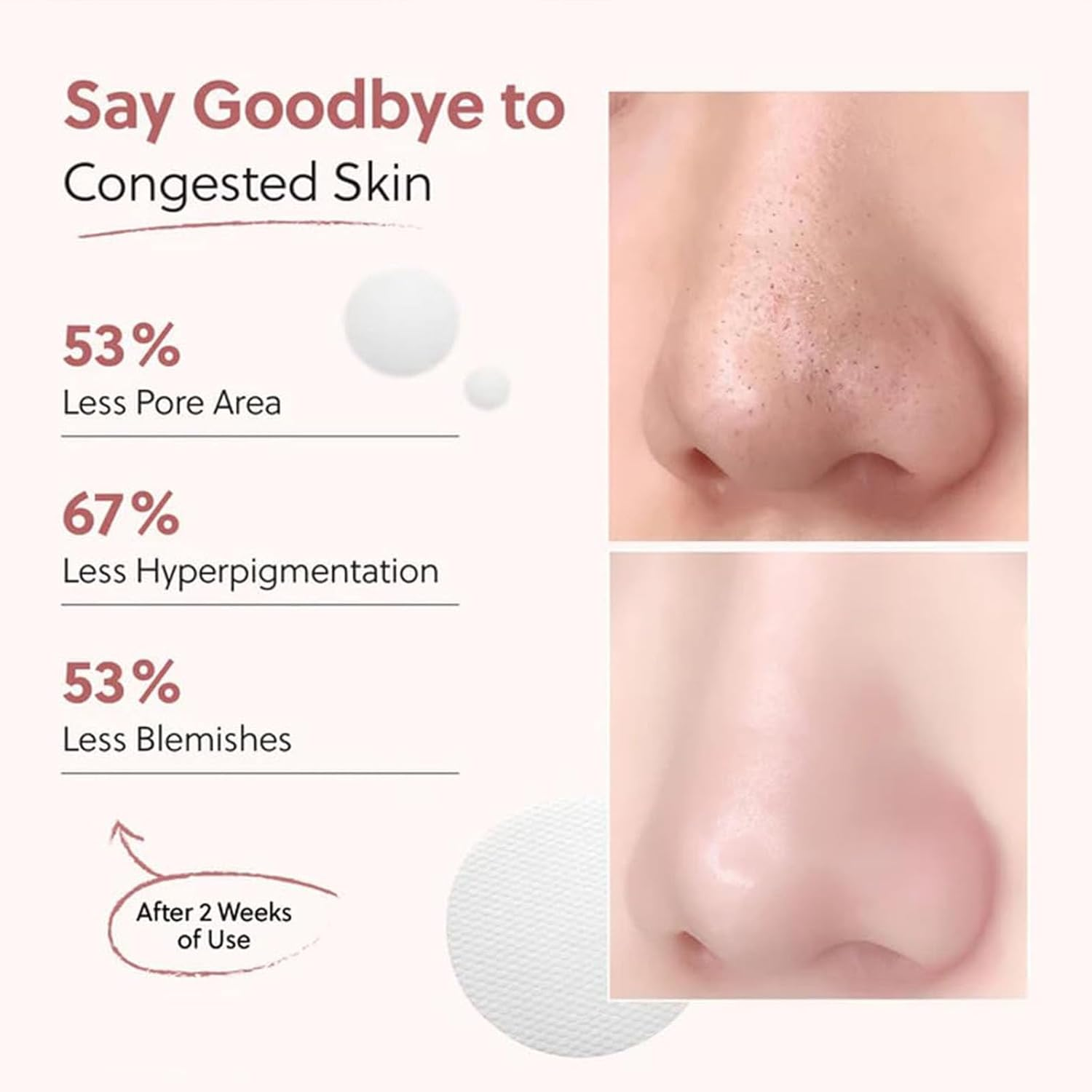 Zero Pore Pads, Korean Beauty Pore Pads, Deep Cleansing & Pore Minimizing, Dual-Textured Exfoliating Facial Pad to Smooths Skin Texture & Brightens Skin (1Pcs) image number 6