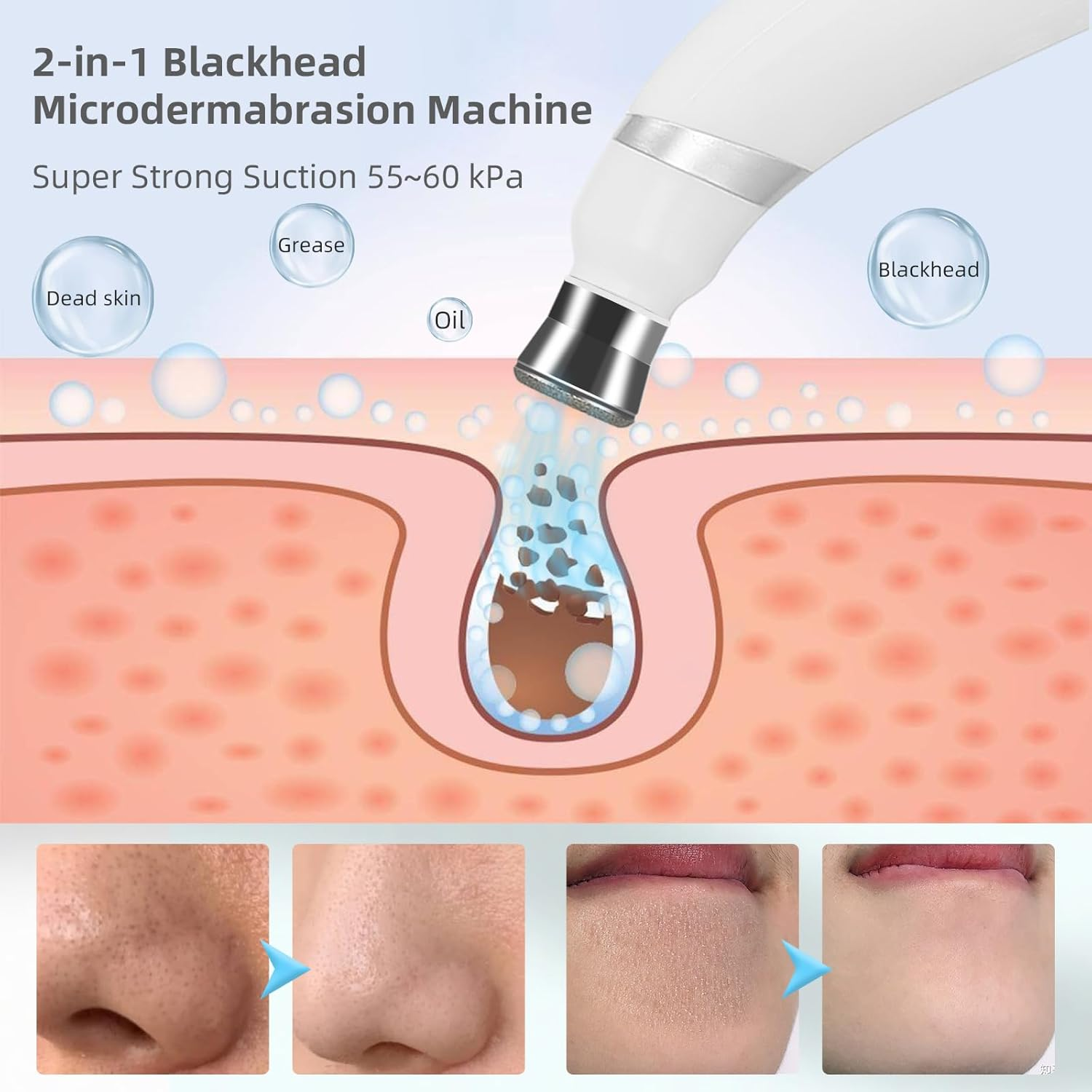 Iebilif Diamond Microdermabrasion Machine, 3 Modes Diamond Microdermabrasion Dermabrasion Machine for Blackhead Removal, Professional Portable Home Travel Microdermabrasion Device image number 3