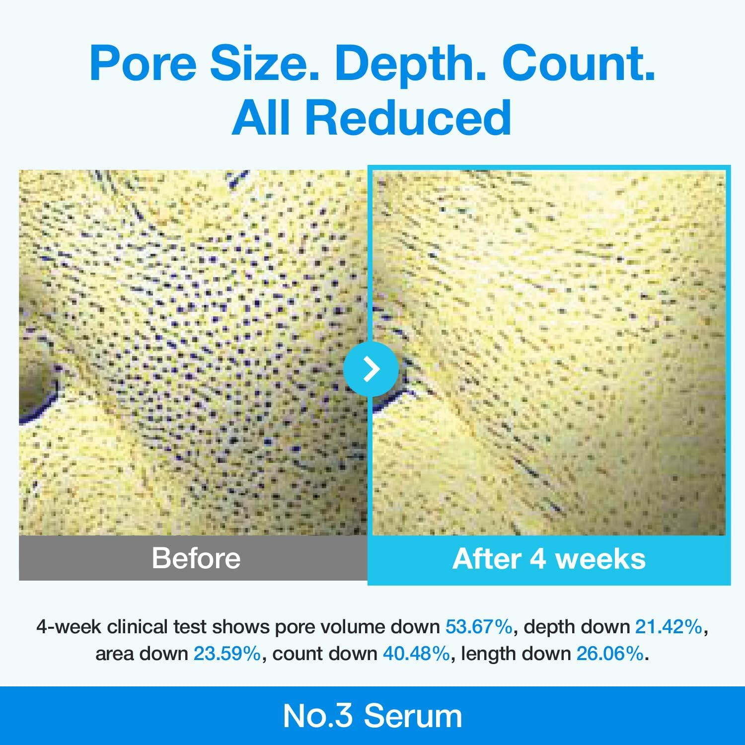 Numbuzin No.3 Serum | Blue Retinol Pore Refining Serum | Pore Tightening, Firming, Anti-Aging, Korean Skincare | Niacinamide, Peptide, Salicylic Acid (BHA) | Beginner-Friendly Retinol | 1.01 Fl.0Z image number 3