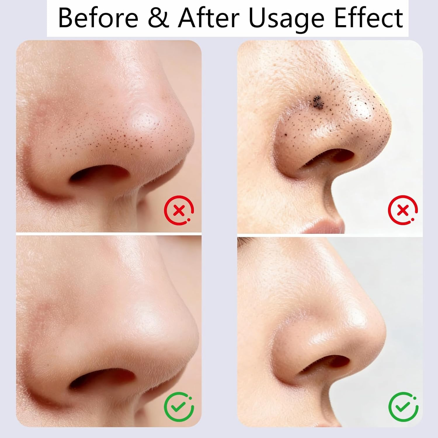 JANGJANG Blackhead Remover Tool Set, 3 Pack Silicone Face Scraper Deep Cleansing Skin Scrubber Nose Pore Cleaner Skincare Tools for Men and Women Professional Facial Care Kit image number 5