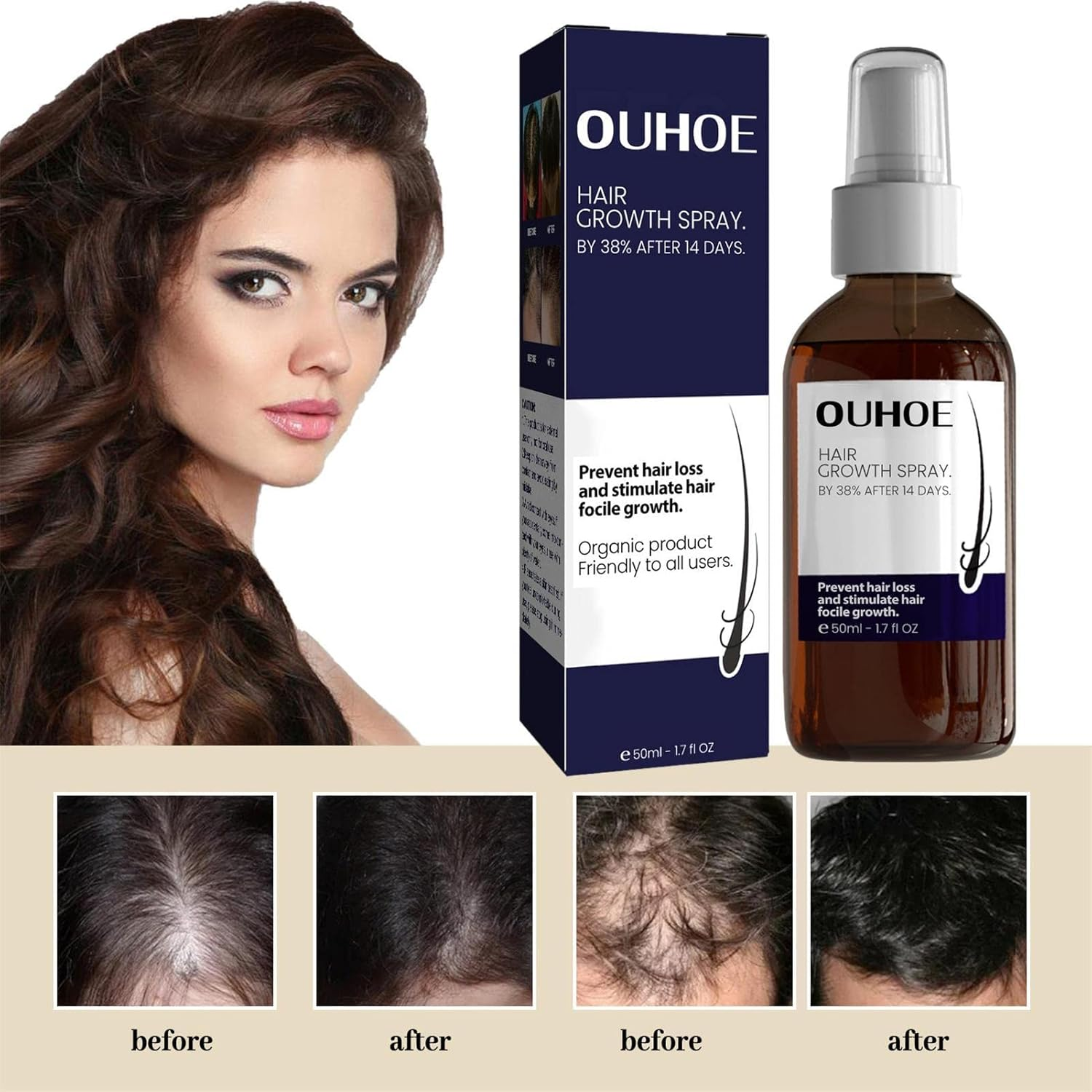 Hair Conditioner Spray,2.11Oz Hair Booster Spray | Plant Extracts Hair Regrowth Extended Nozzle Sprayer for Repairs Damaged Hair Pisole image number 4