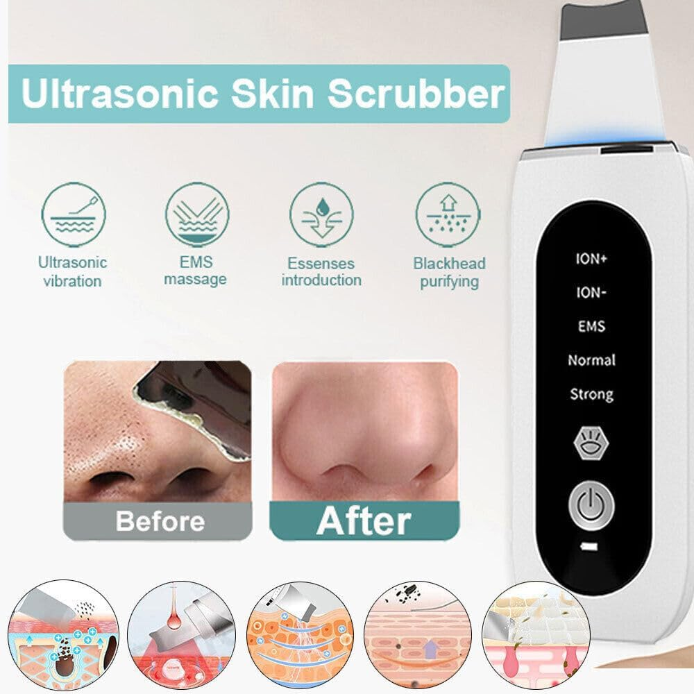 Havvo Ultrasonic Facial Skin Scrubber Face Pore Deep Cleaner Spatula Blackhead Remover image number 6
