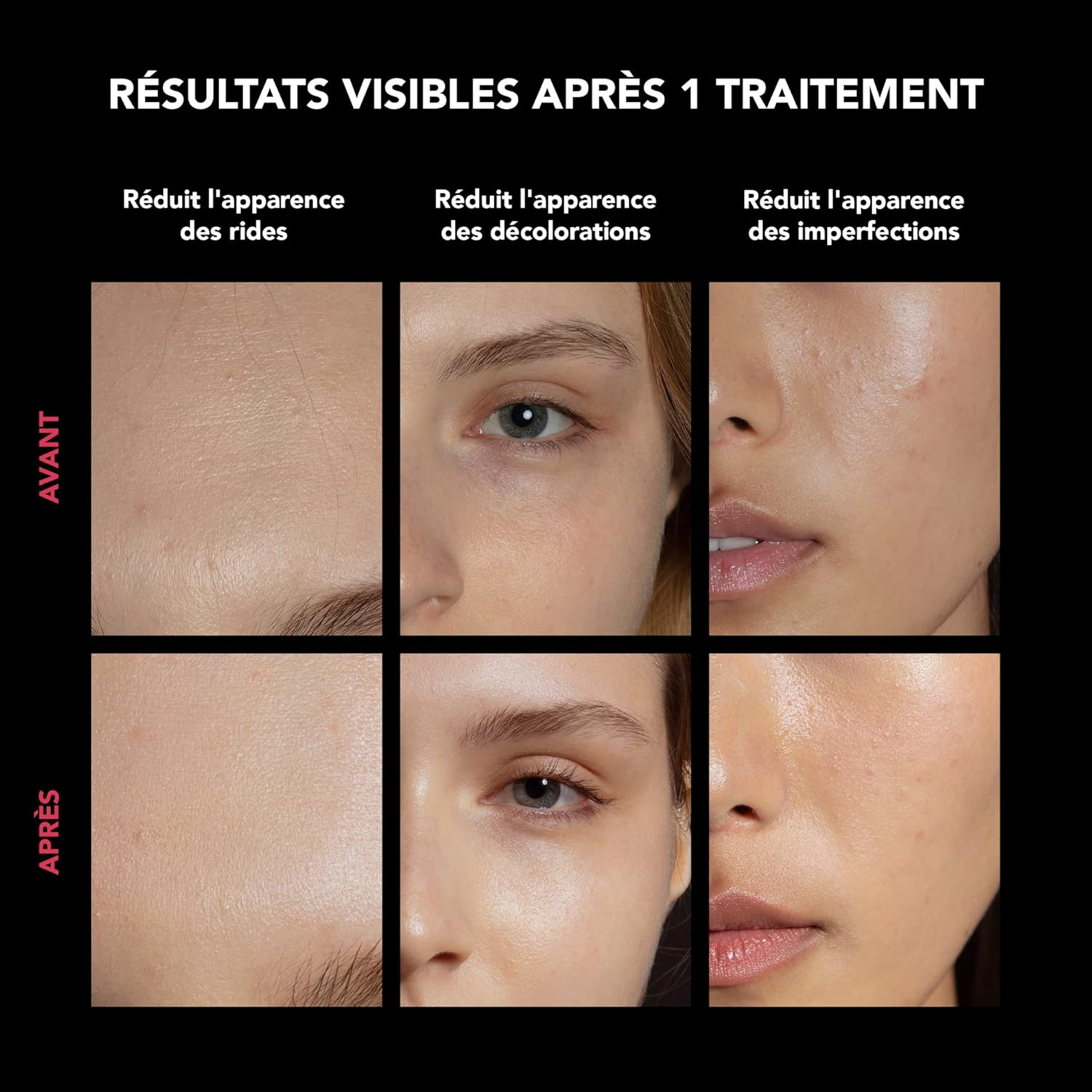 FAQ 202 Advanced NIR + 7 LED Lights Face Mask - for Spots & Mild Acne - Face Masks Skincare - Wireless Face Masks Beauty - 600 Glow Points - Wearable Skin Care image number 3